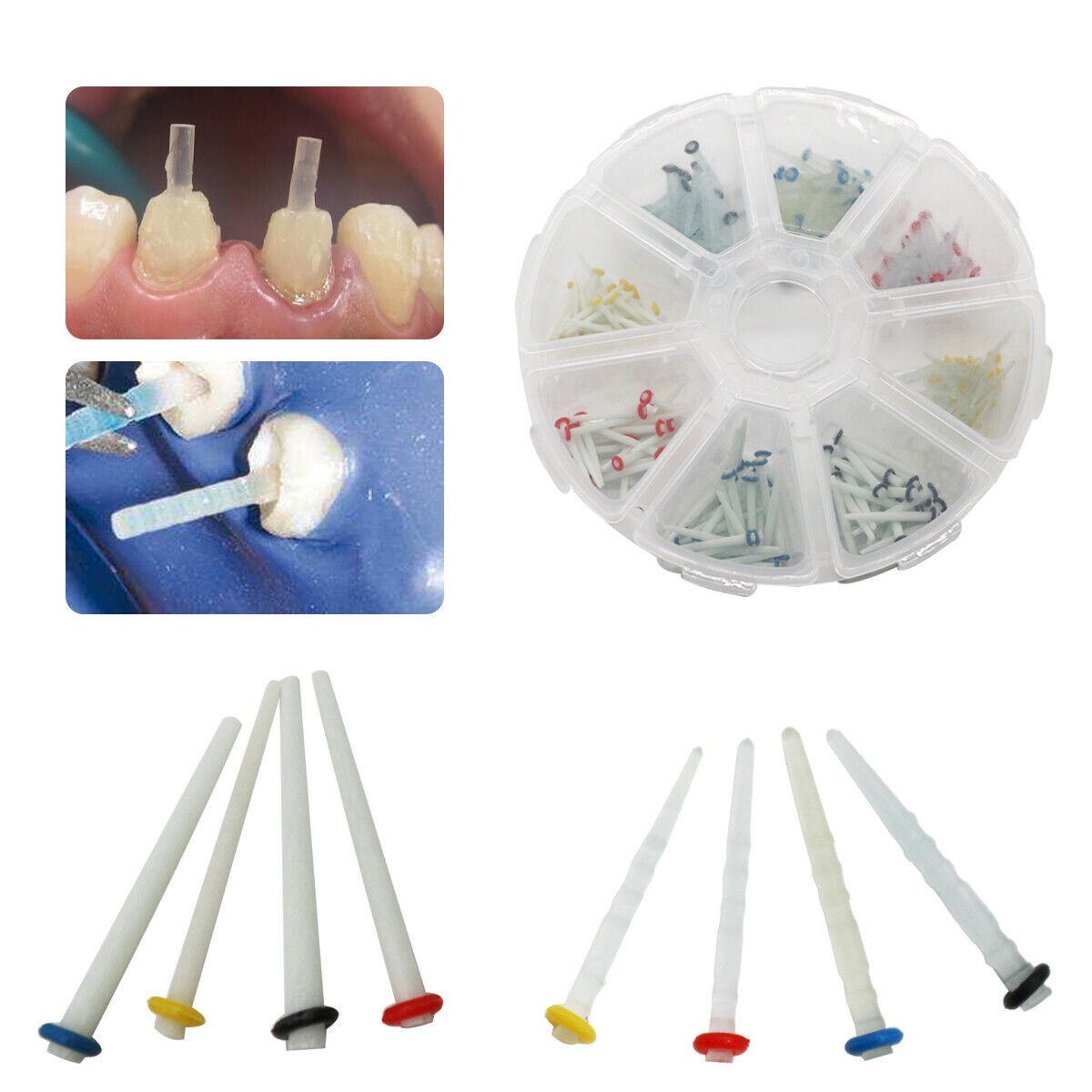 200 Pcs Dental Fiber Post Glass Quartz Teeth Restorative 1.2 1.4 1.6 1.8mm Posts