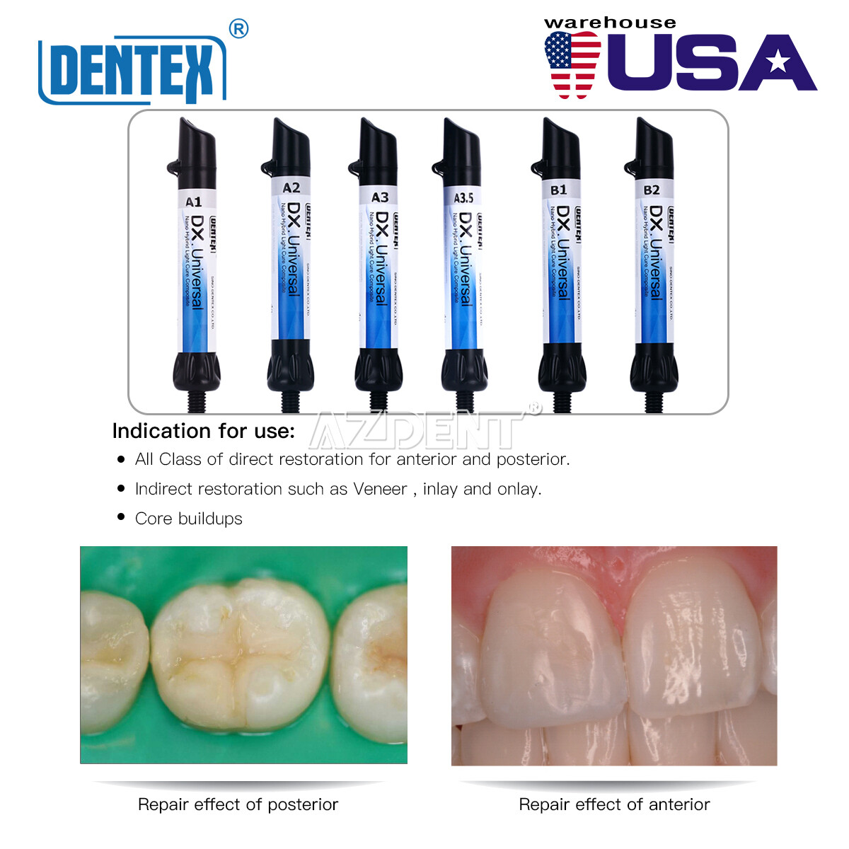 Dentex Dental Composite Light Cure Universal Resin /Acid Etching Gel 37%/Bonding