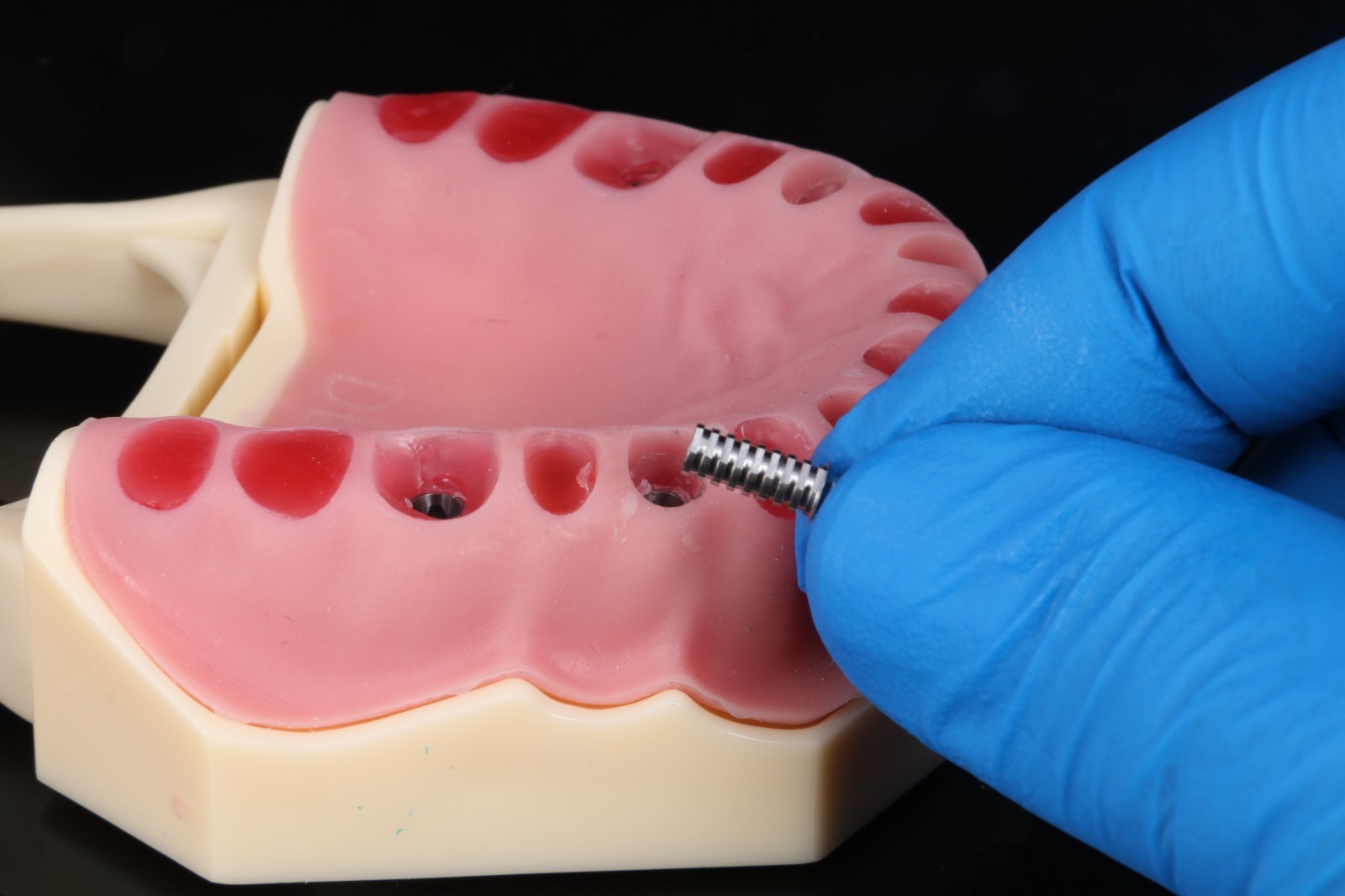 Natural Emergence Profiler, Dental Implant,Dental Laboratory,Dentistry