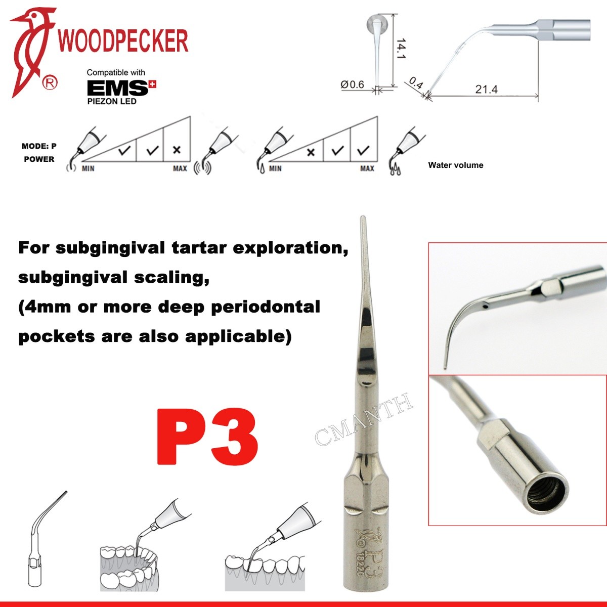 Woodpecker Dental Ultrasonic Scaler Tips P1-P33 Period Tips Fit EMS Scaler