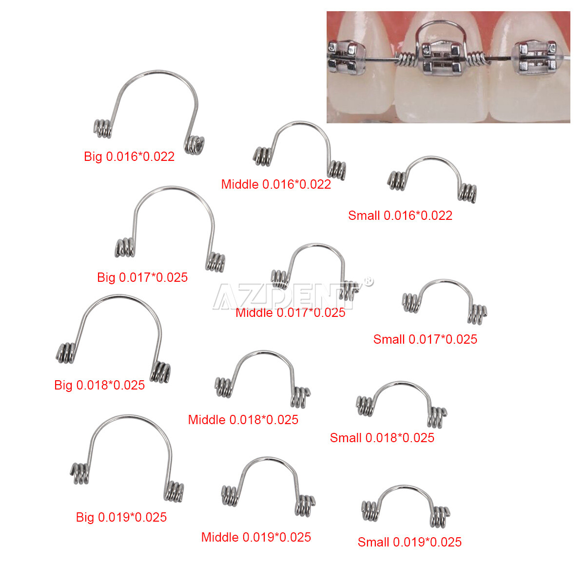 Dental Orthodontic Anterior Teeth Tooth Torque Rectangular Springs 10Pcs/Bag
