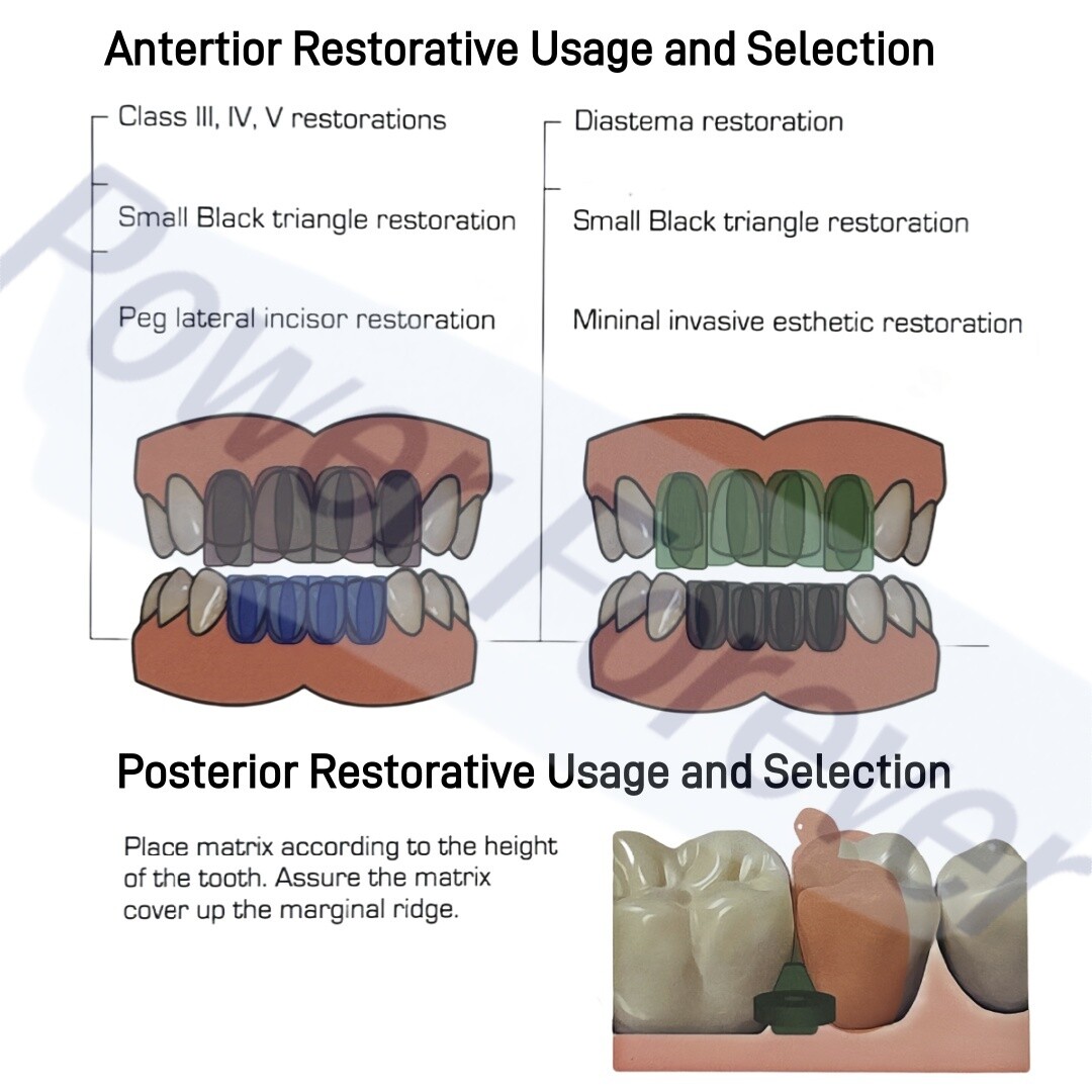 Dental Clear Matrix Anterior Posterior Restorative BT Bow Matrices Fit BioClear