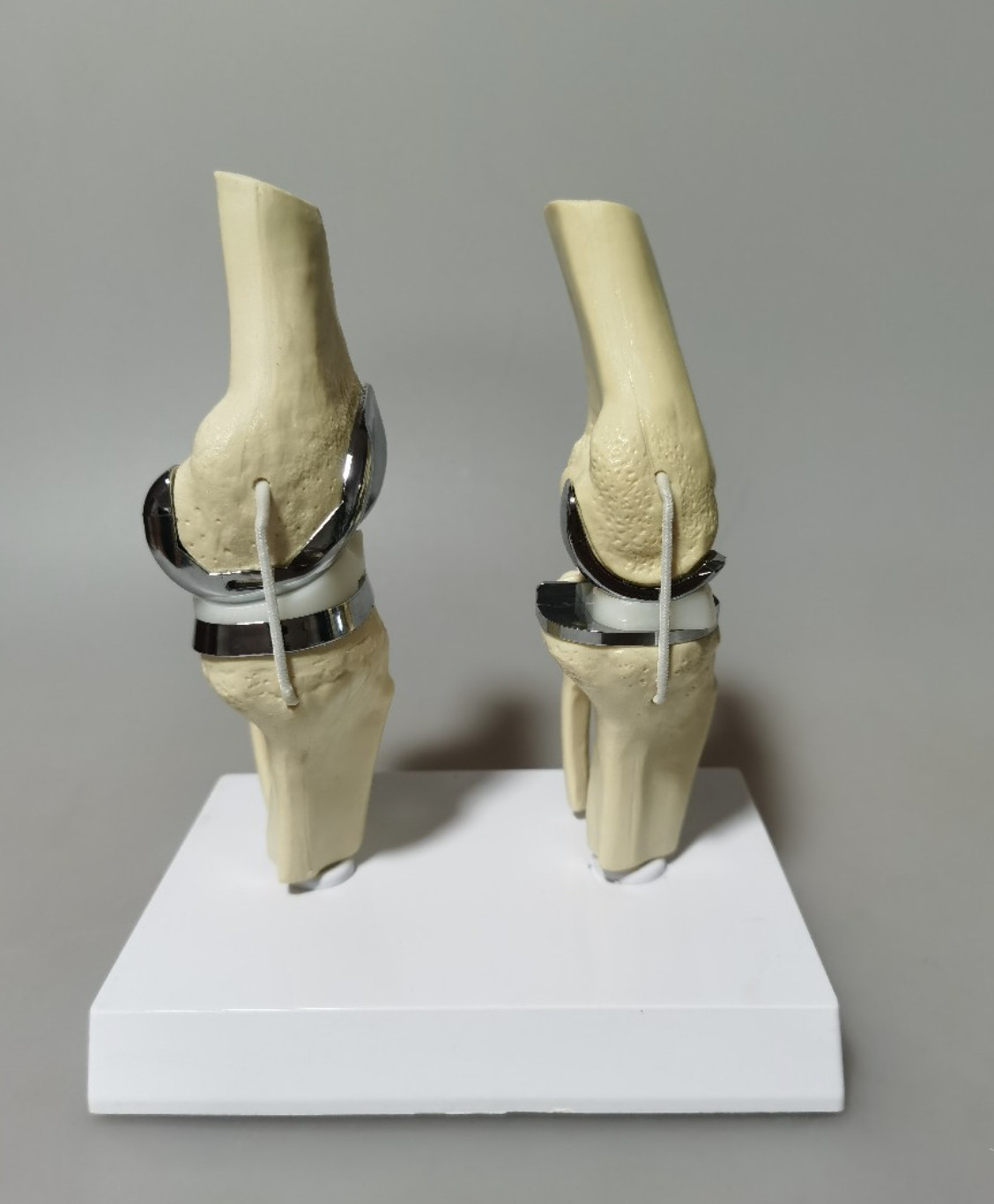 Artificial Shoulder Replacement Anatomical Model Knee Shoulder Elbow Joint Model
