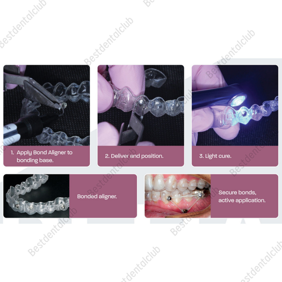 Dental Light Cure Orthodontic Adhesive Paste Kit for Aligner Attachments