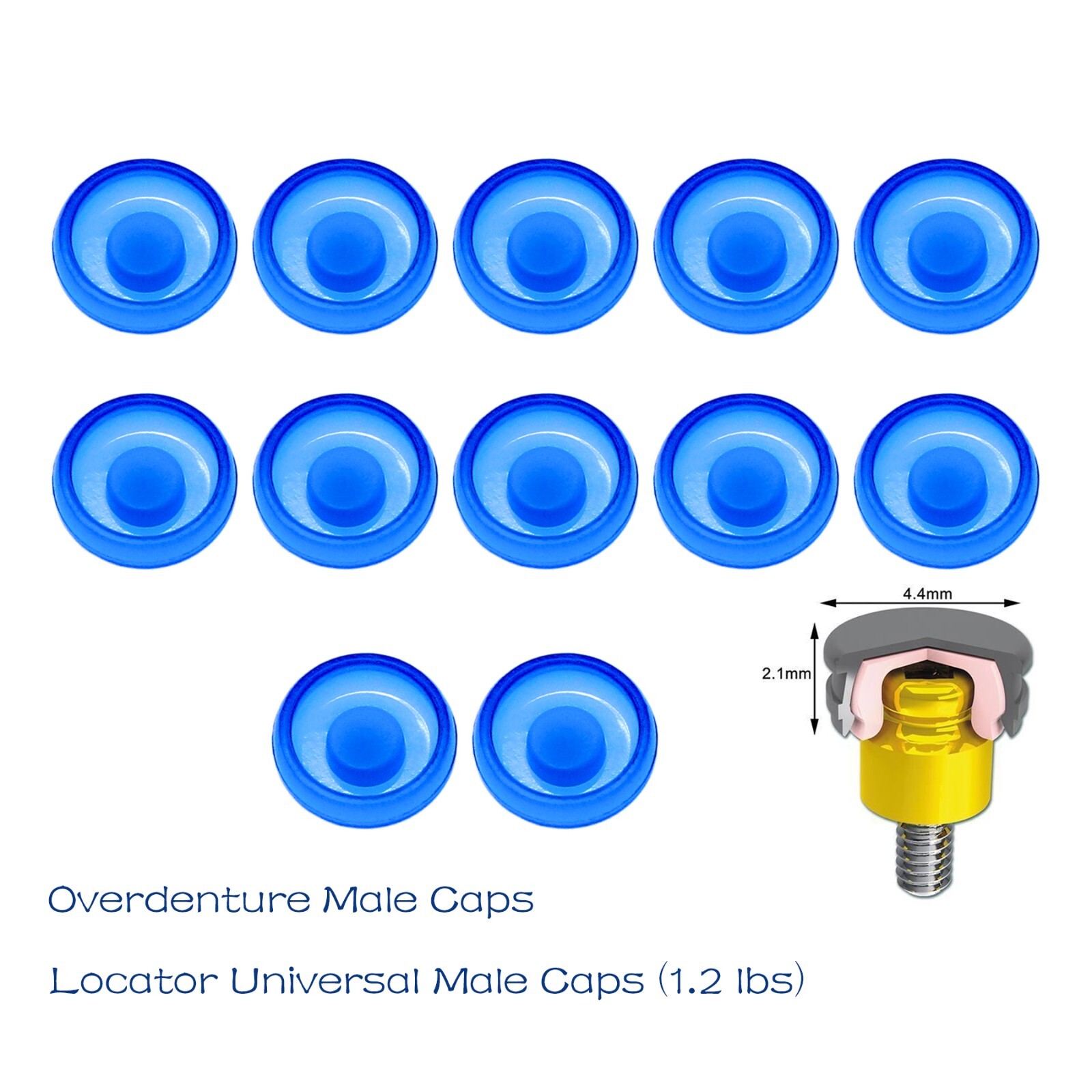 US Dental Attachment System Locator Abutment Retention Caps Replace Inserts Set