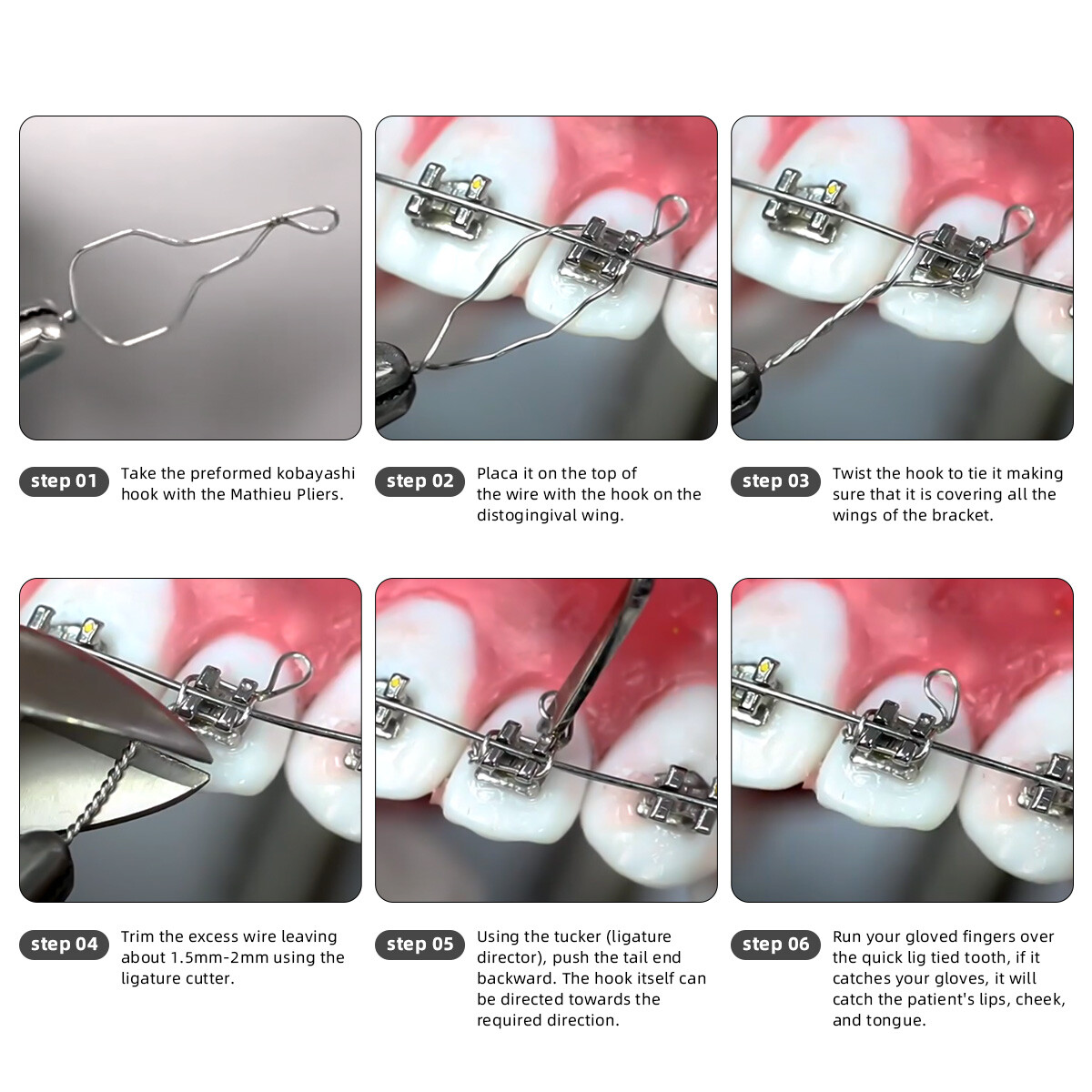 Dental Orthodontic SS Wires Kobayashi Preformed Ligature Ties Long/Short/Twist