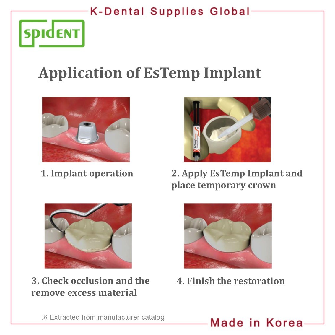Spident EsTemp Implant Temporary Resin Cement 8g
