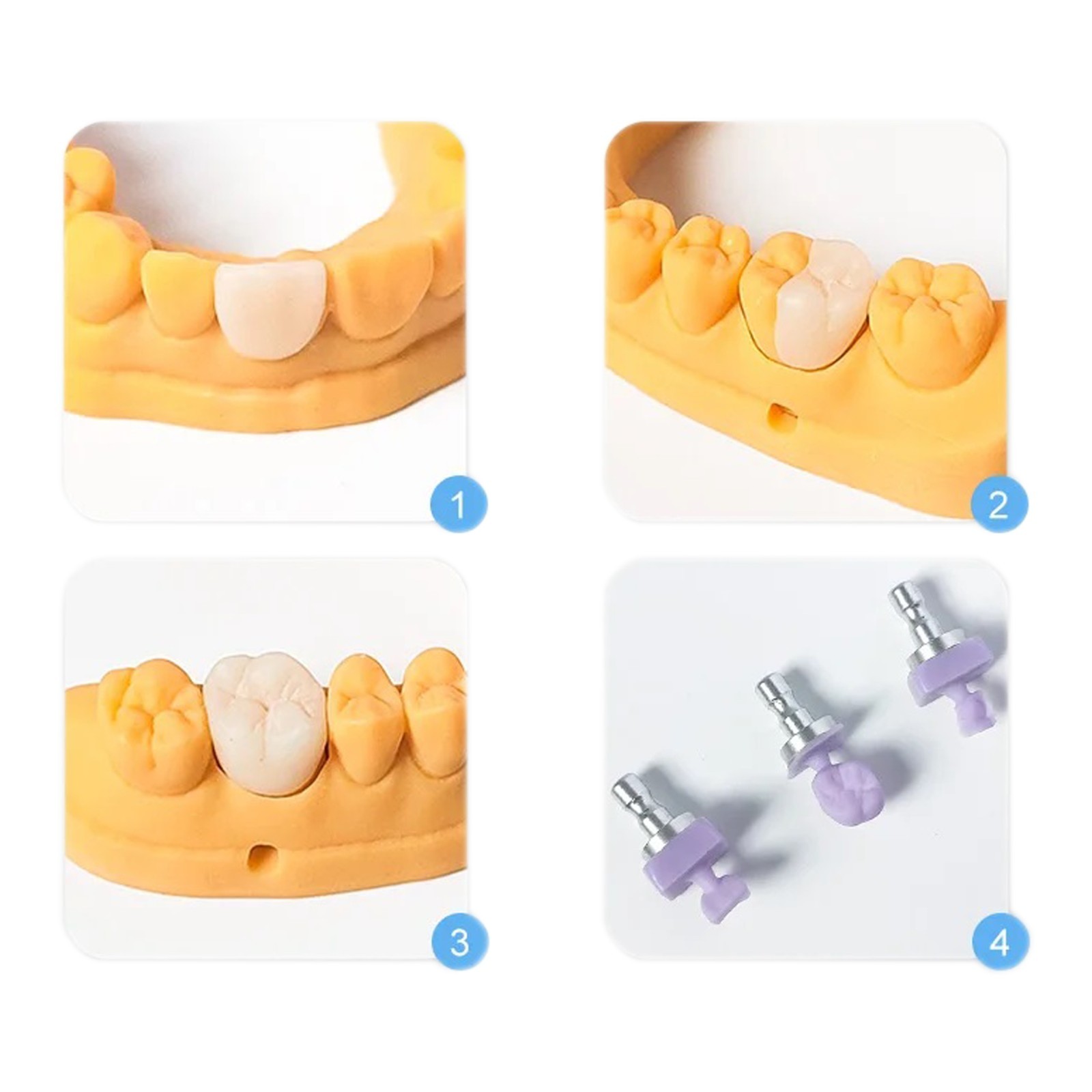 C14 Dental Emax Ceramic Blocks Lithium Disilicate Block CAD/CAM CEREC-5Pcs/BOX