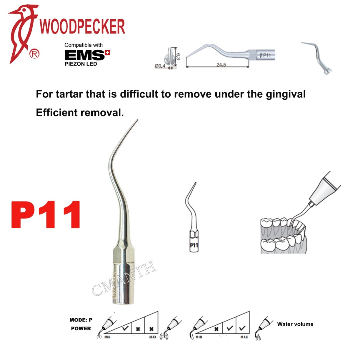 Woodpecker Dental Ultrasonic Scaler Tips P1-P33 Period Tips Fit EMS Scaler