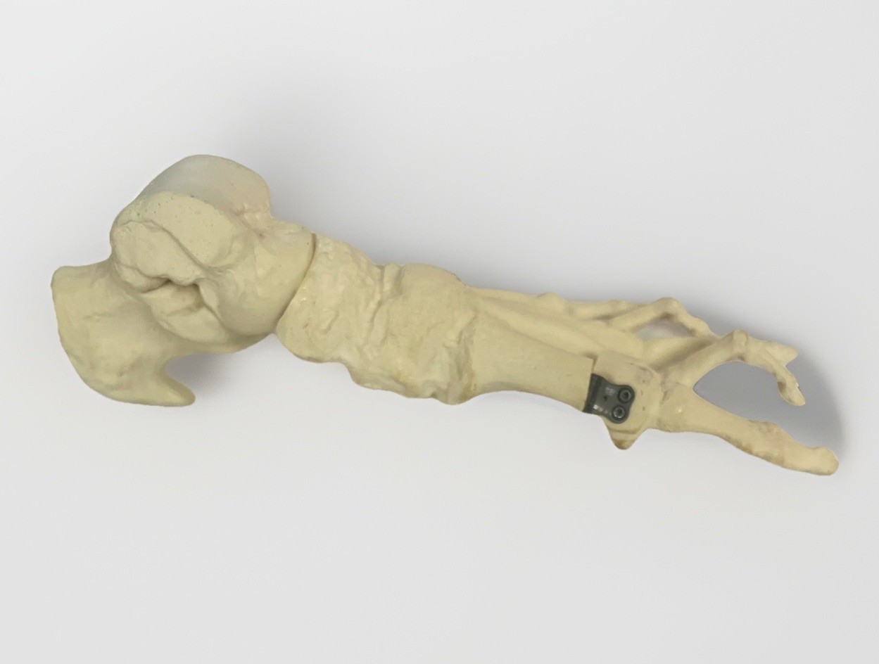 Anatomic and Pathological Foot Skeletal Models Foot Surgery, Podiatry, Orthopods