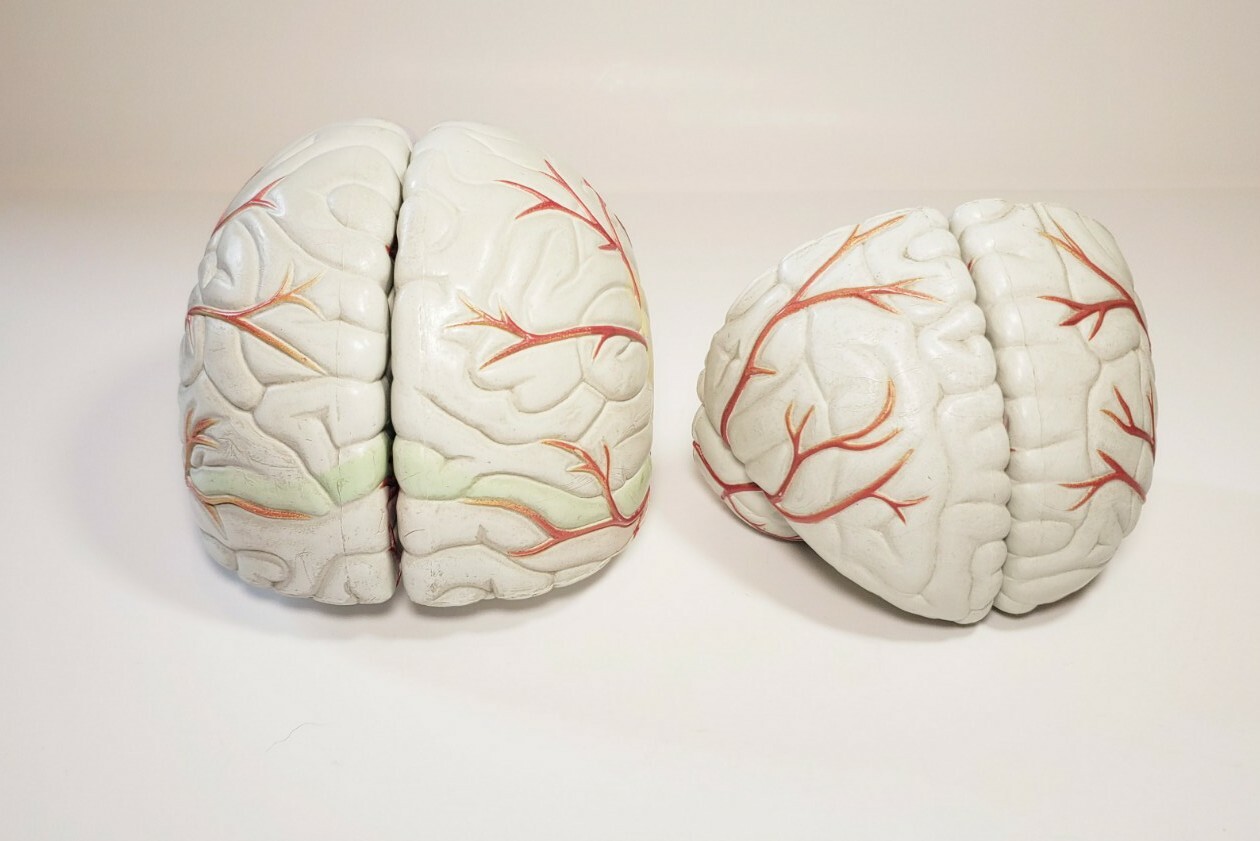 Human Brain Anatomical Teaching Model Life Size Medical Science Cross 4 Sections