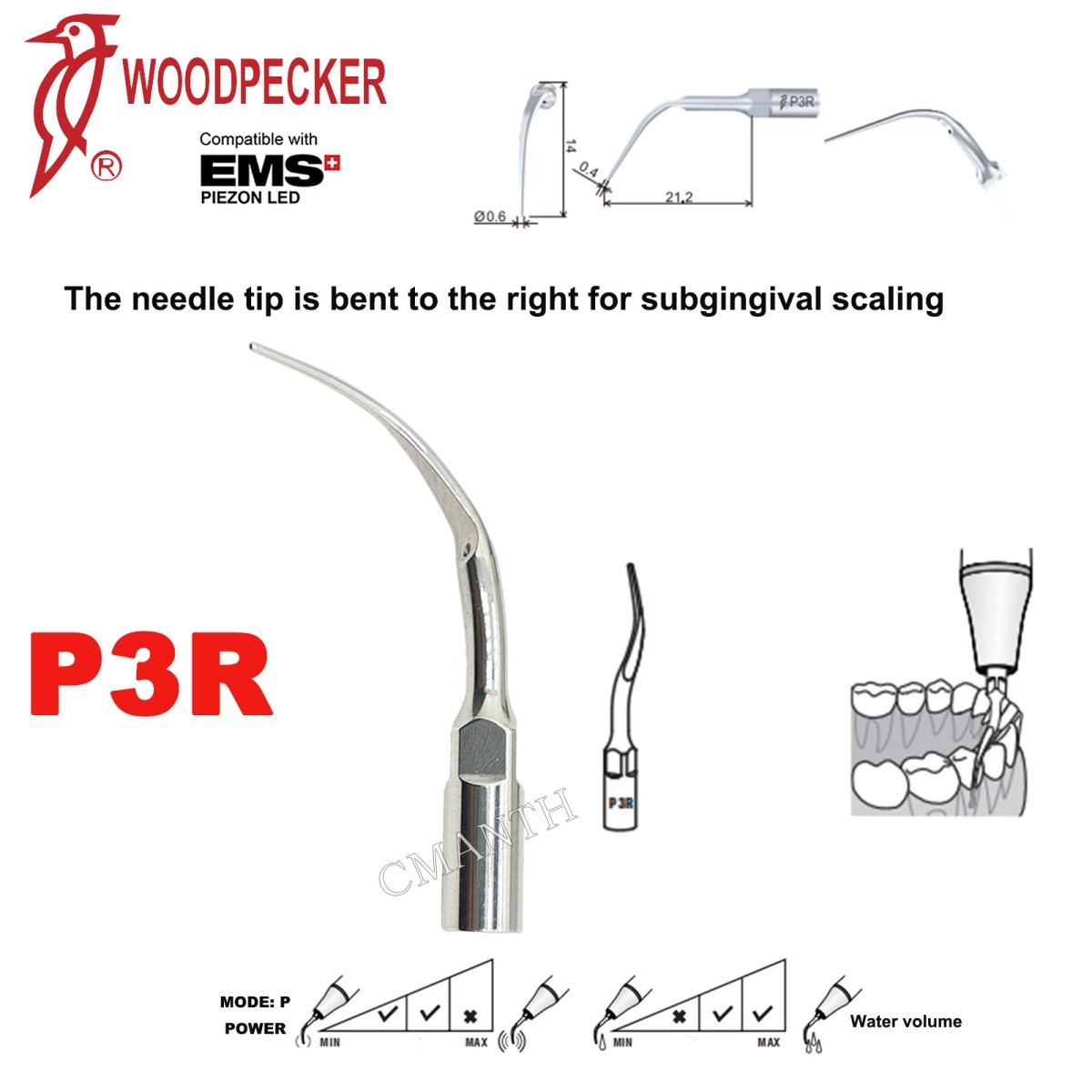 Woodpecker Dental Ultrasonic Scaler Tips P1-P33 Period Tips Fit EMS Scaler