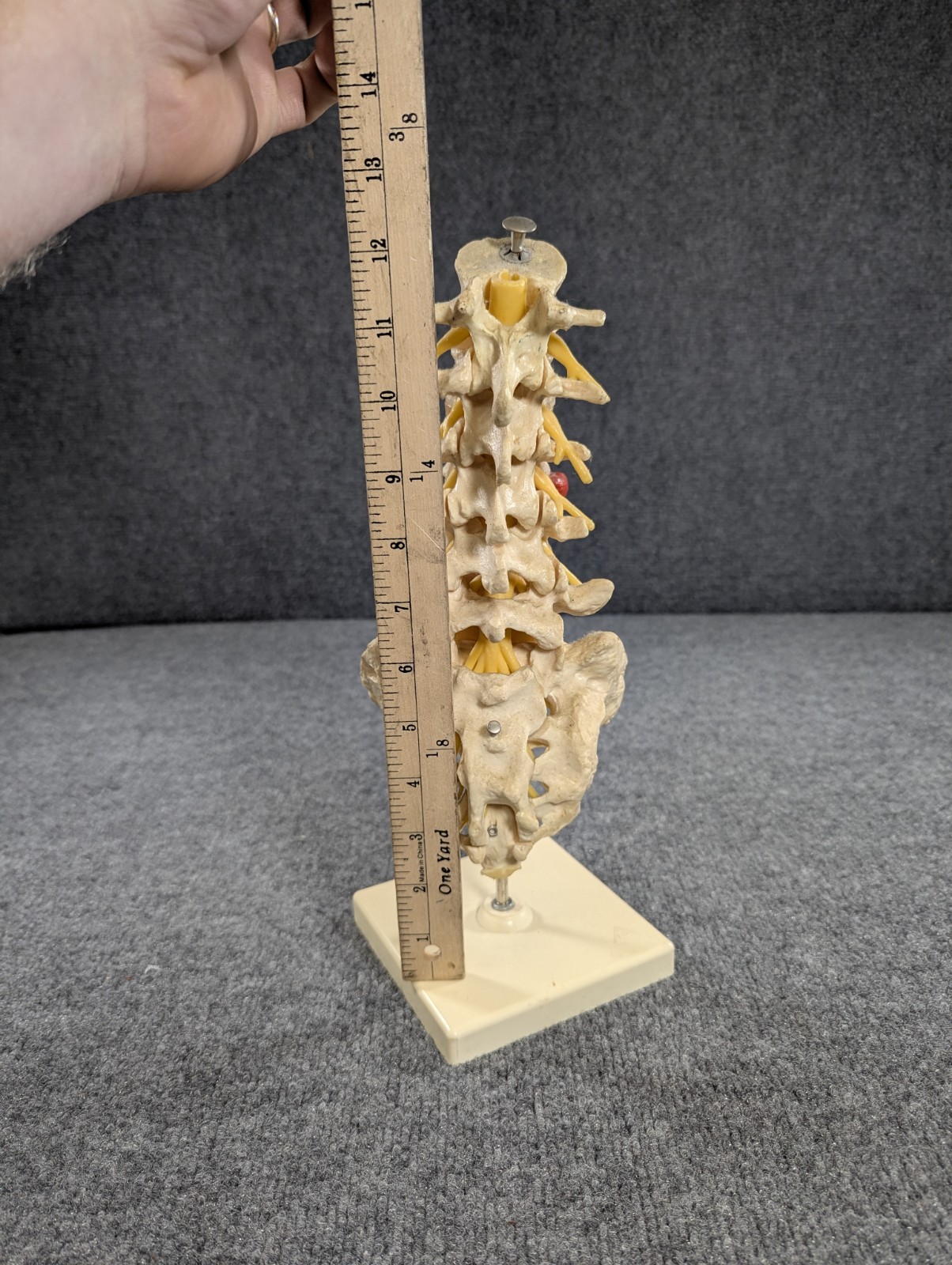 Human Lumbar Spinal Column 3B Scientific Anatomical Model Anatomy West Germany