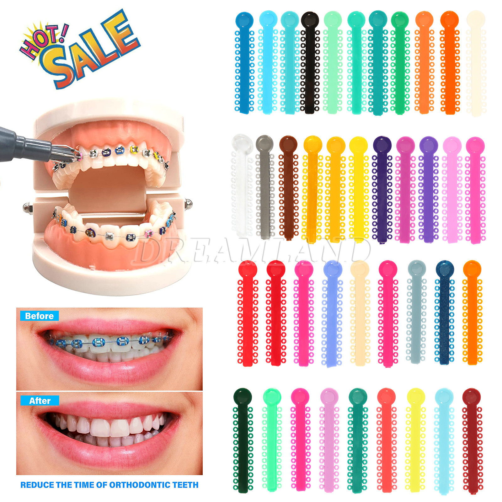 1040Pcs/Bag Dental Orthodontics Ring Elastic Latex Bands Ligature Ties 43 Colors