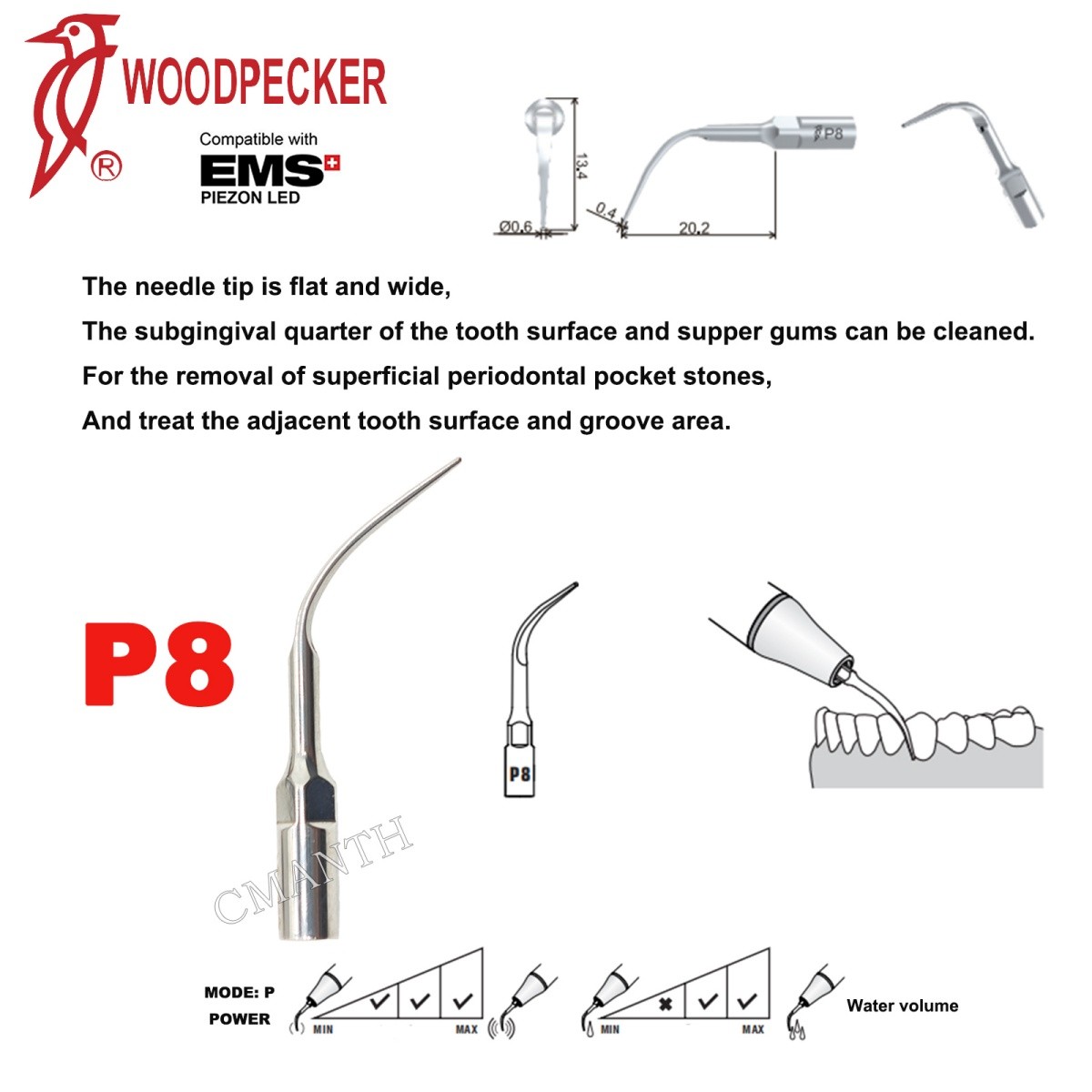 Woodpecker Dental Ultrasonic Scaler Tips P1-P33 Period Tips Fit EMS Scaler