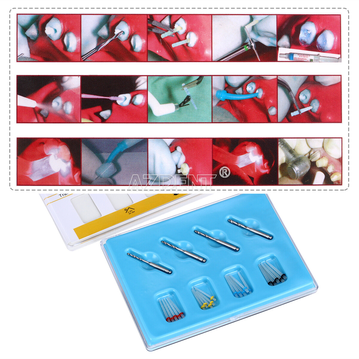 1Box Dental Endo Fiber Post Glass Quartz Teeth Restorative 1.0 1.2 1.4 1.6 1.8m