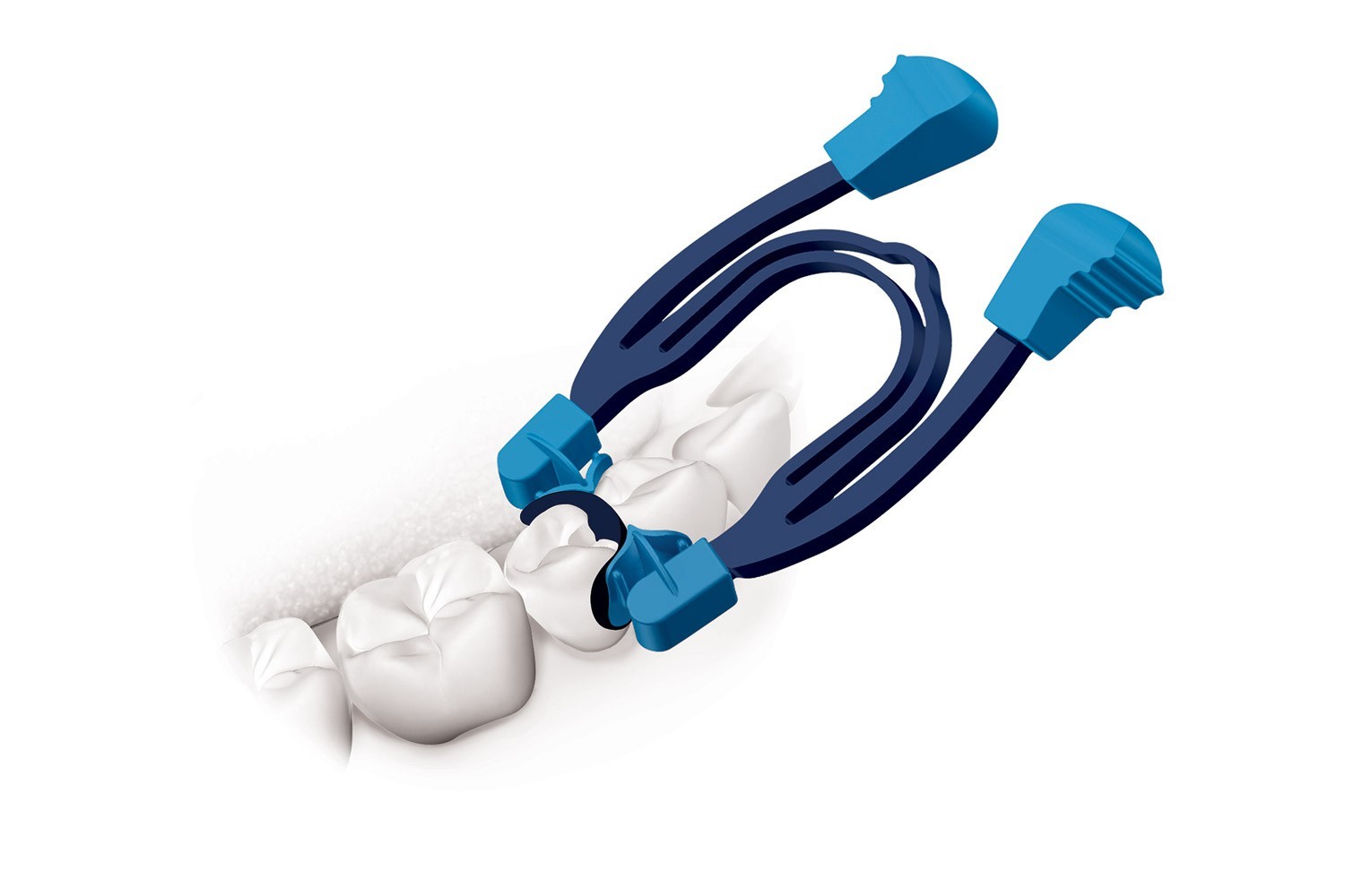 Polydentia MyClip 2.0 All-in-one Sectional Matrix System (Made in Switzerland)