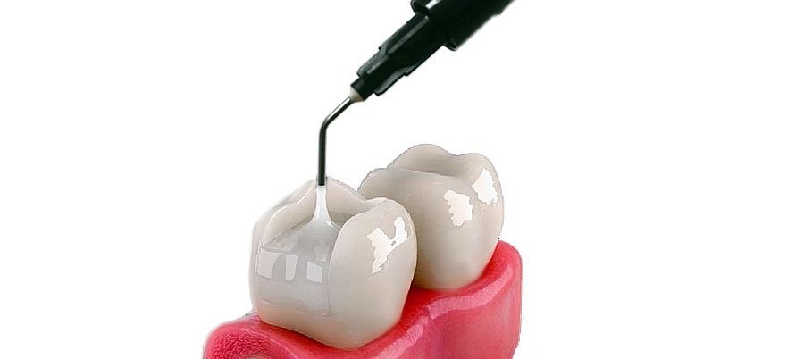 Ivoclar Dental TETRIC N CERAM LC Nano Hybrid Restorative Composite VARIOUS SHADE