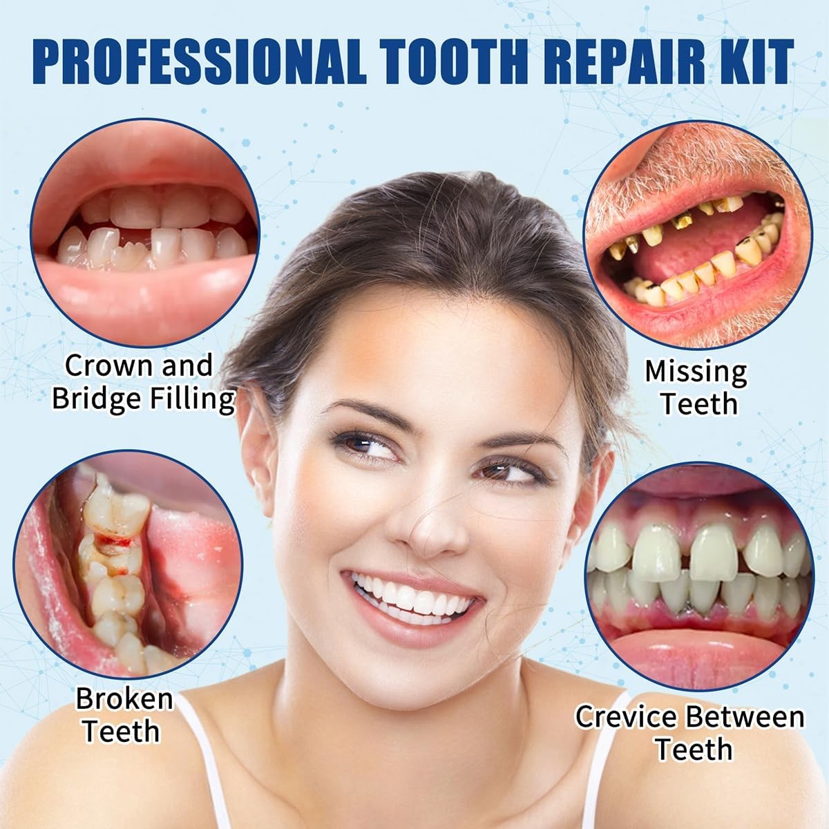 Zinc Oxide Eugenol Cement Dental Filling Kit Temporary Tooth Repair Tool