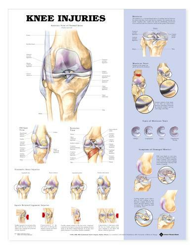 KNEE INJURY Laminated Wall Chart 20″ x 26″ Classroom/Professional LFA #99872