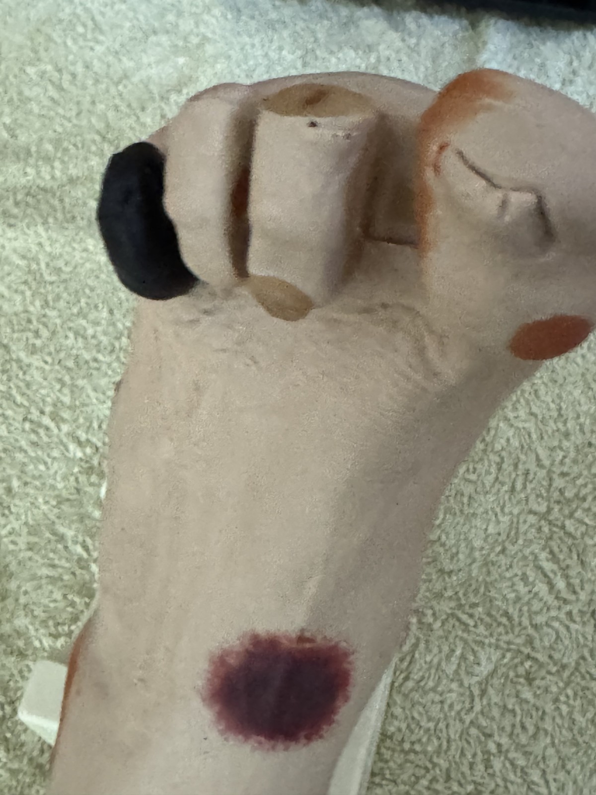 VATA Wilma Wound Foot Teaching Model