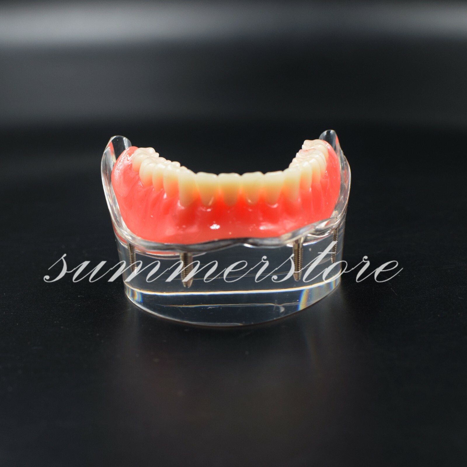 1 Pc Transparent Dental Study Demo 4 Implants Overdenture Inferior Model #6003