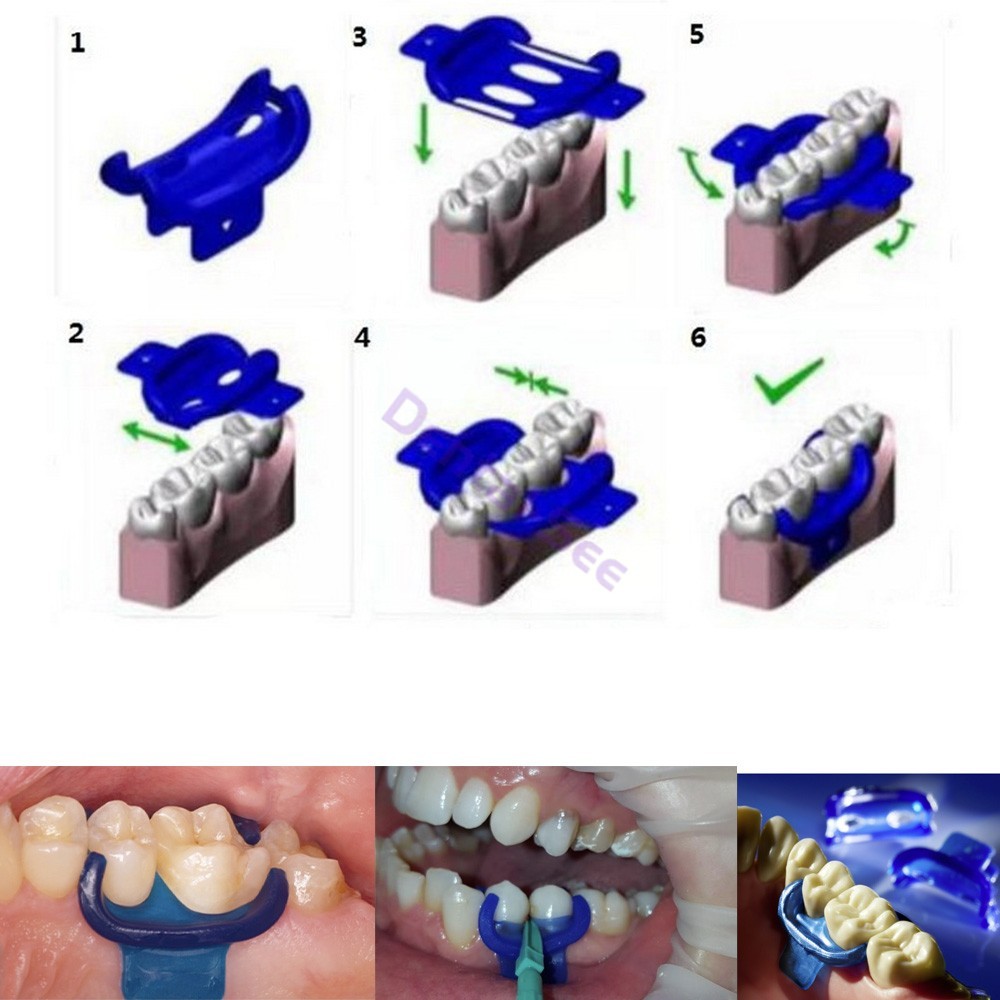 Dental Mini Dam Rubber Clamp Holder Gingival Guard Silicon Clips Autoclavable
