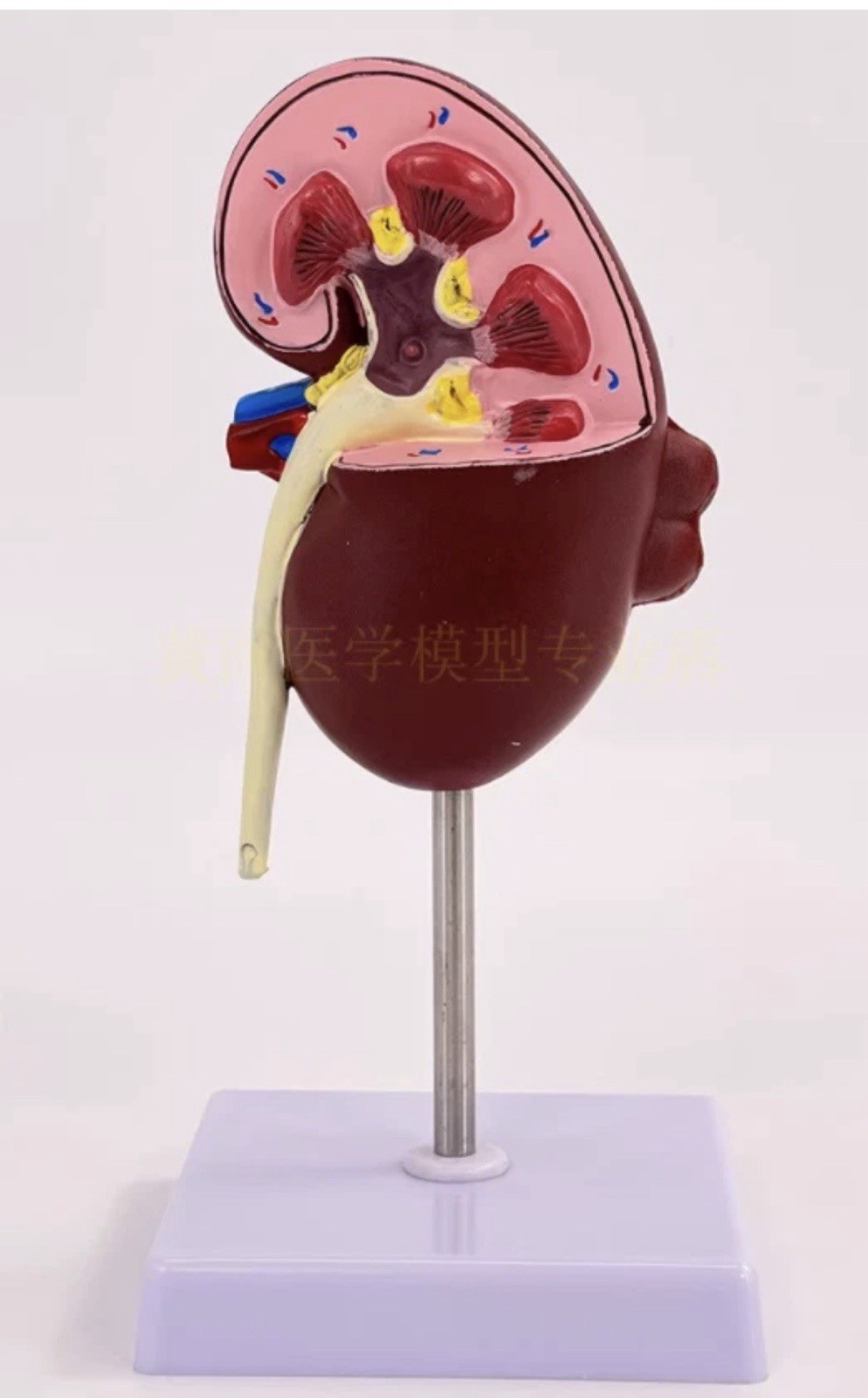NEW Human Normal/Pathological Kidney Model Anatomy Medical Teaching Model