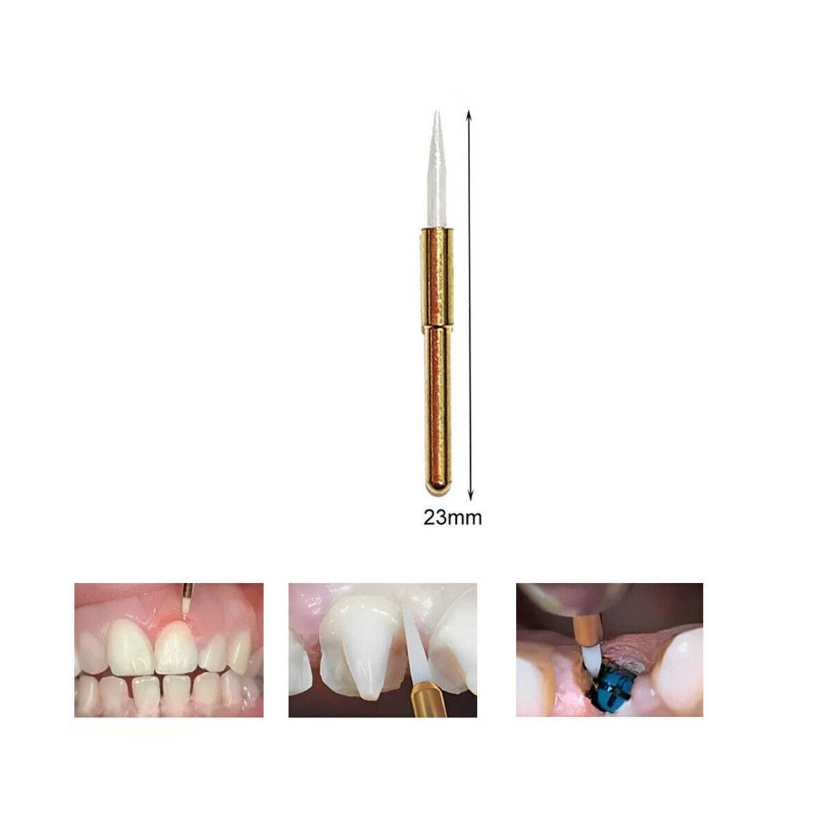 3PCS Dental Soft Tissue Trimmer Surgical Ceramic precise cuts 23mm Bur