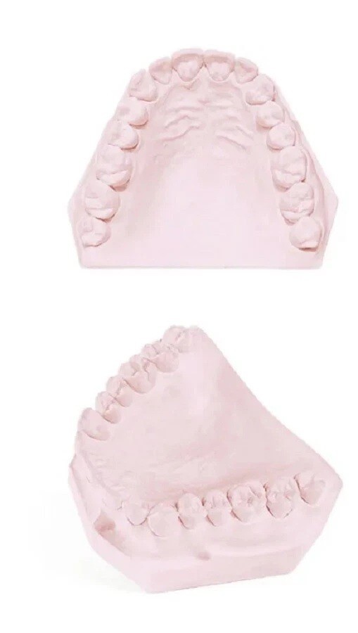 DENTAL LAB GYPSUM DIE STONE TYPE IV PINK ALL PURPOSE STRONG 2-3 Day DELIVERY