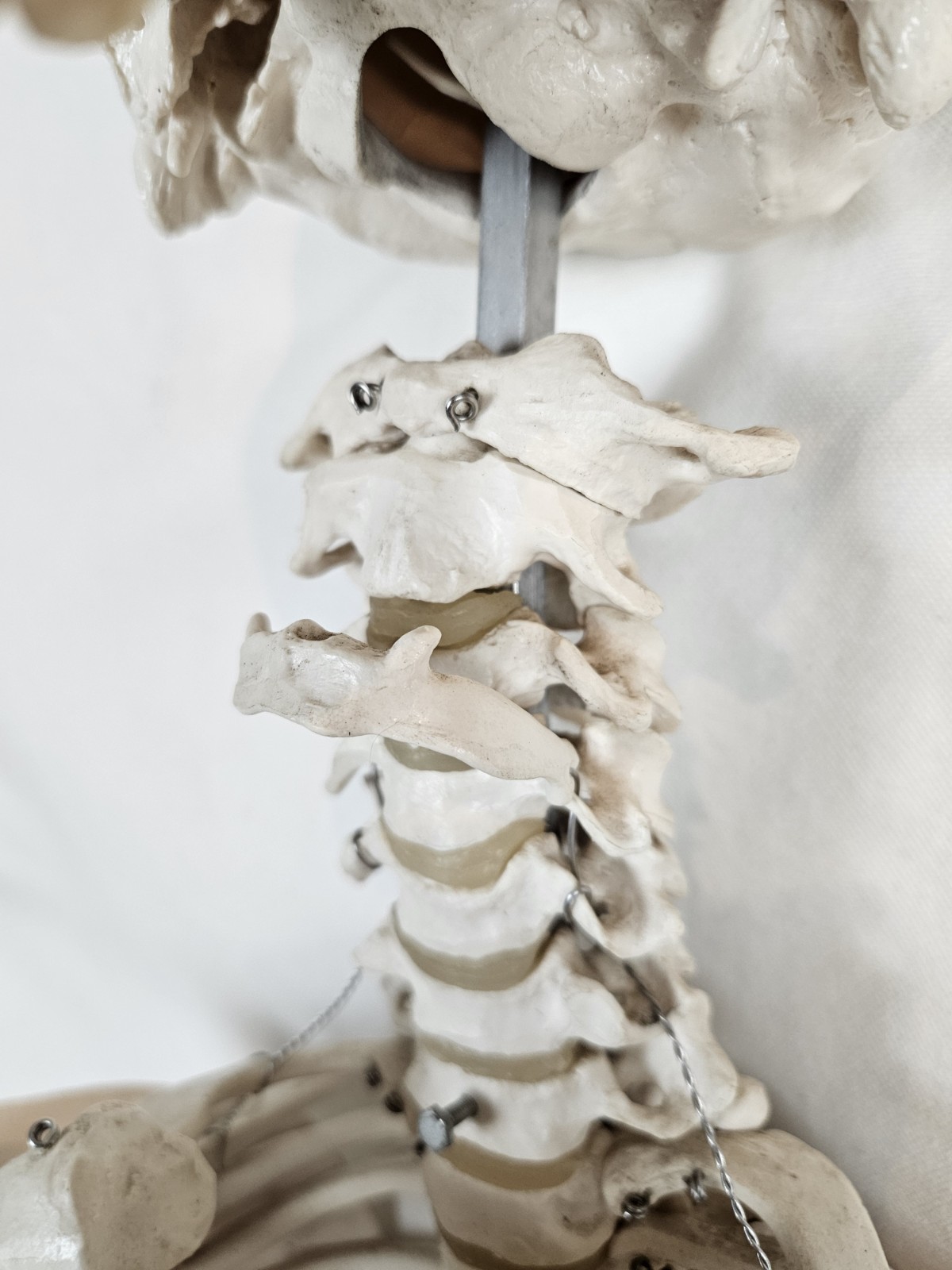 3B Scientific 5′ 6″ Human Skeleton Stan Hanging Model NO MANDIBLE