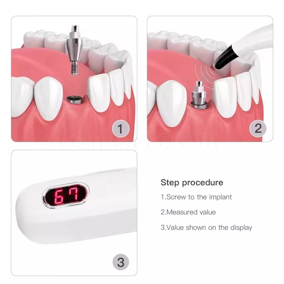 DENTAL NEW OSSTELL BEACON ISQ IMPLANT STABILITY METER TOOL INSTRUMENT