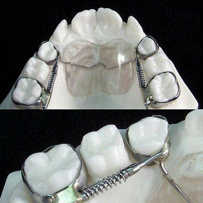 1 Set Molar Distalizer Dental Orthodontic Archwire Buccal Tube Braces Molar Band