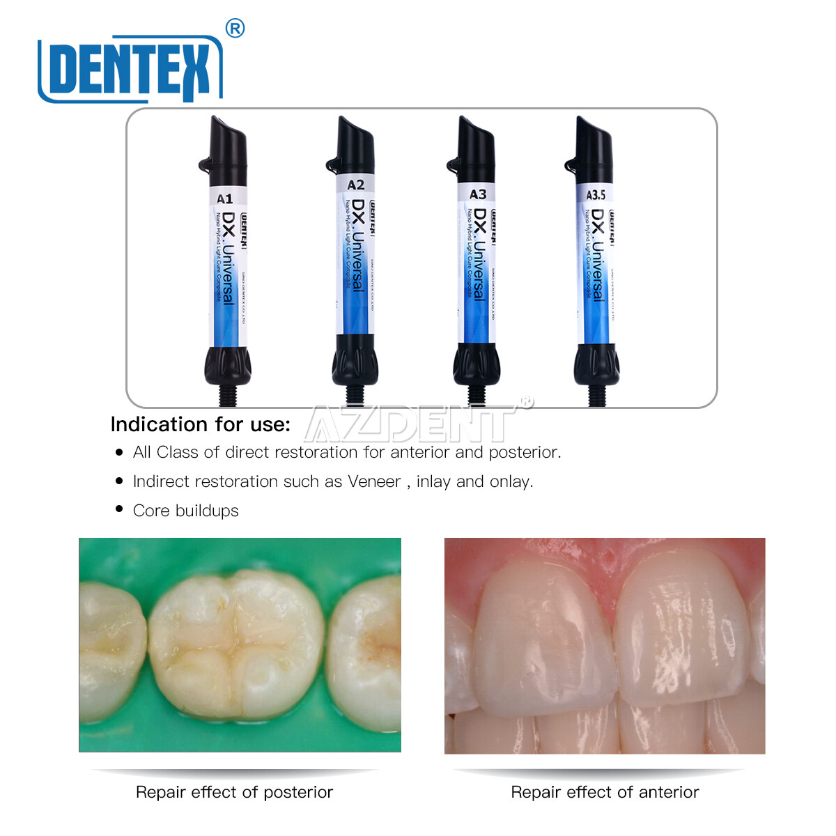 Dental Cure Light Composite Resin A1 A3 / Temporary Filling Material Blue