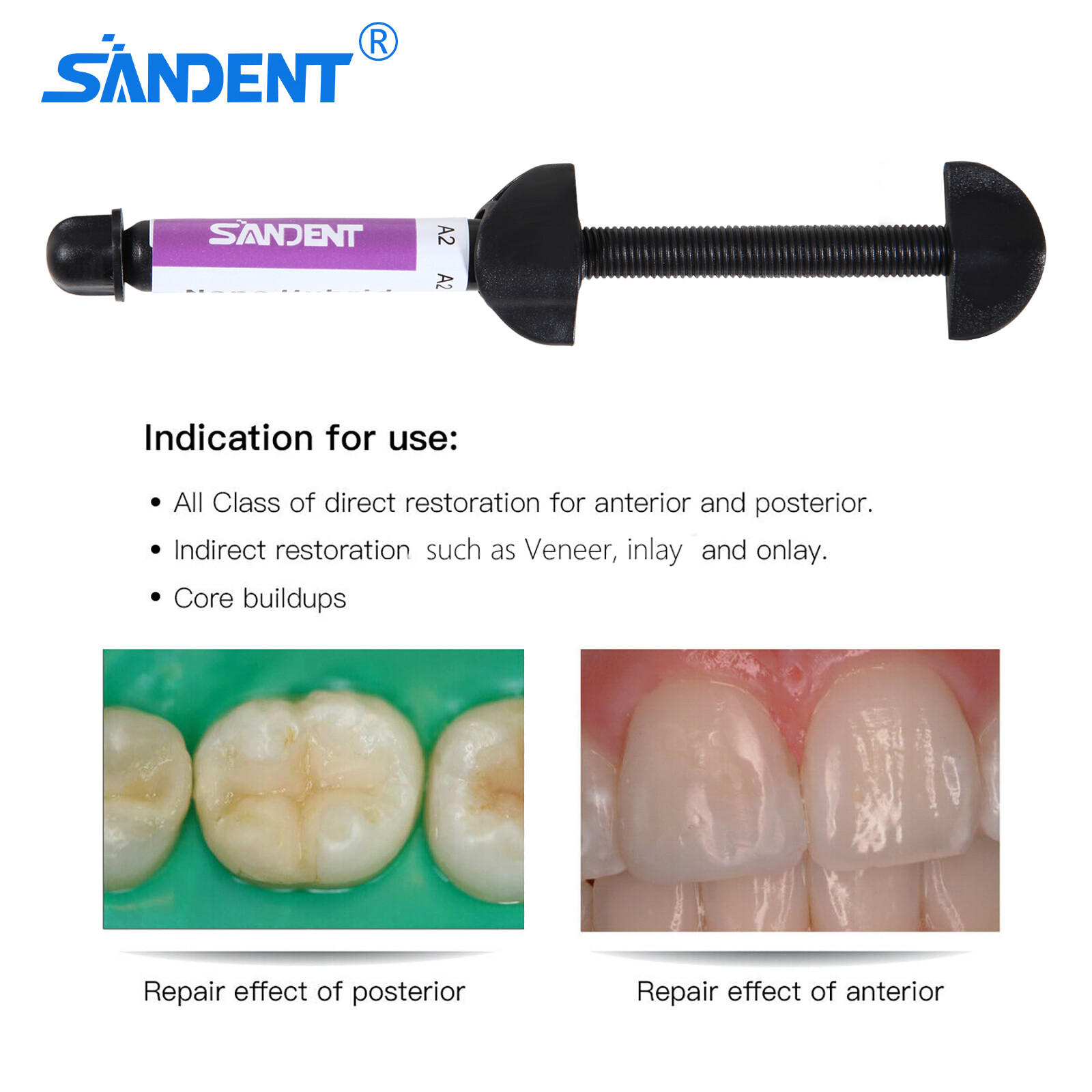 SANDENT Light Cure Hybrid Composite Dental Resin – 4.5 g 001-001 A2 Cure NEW H