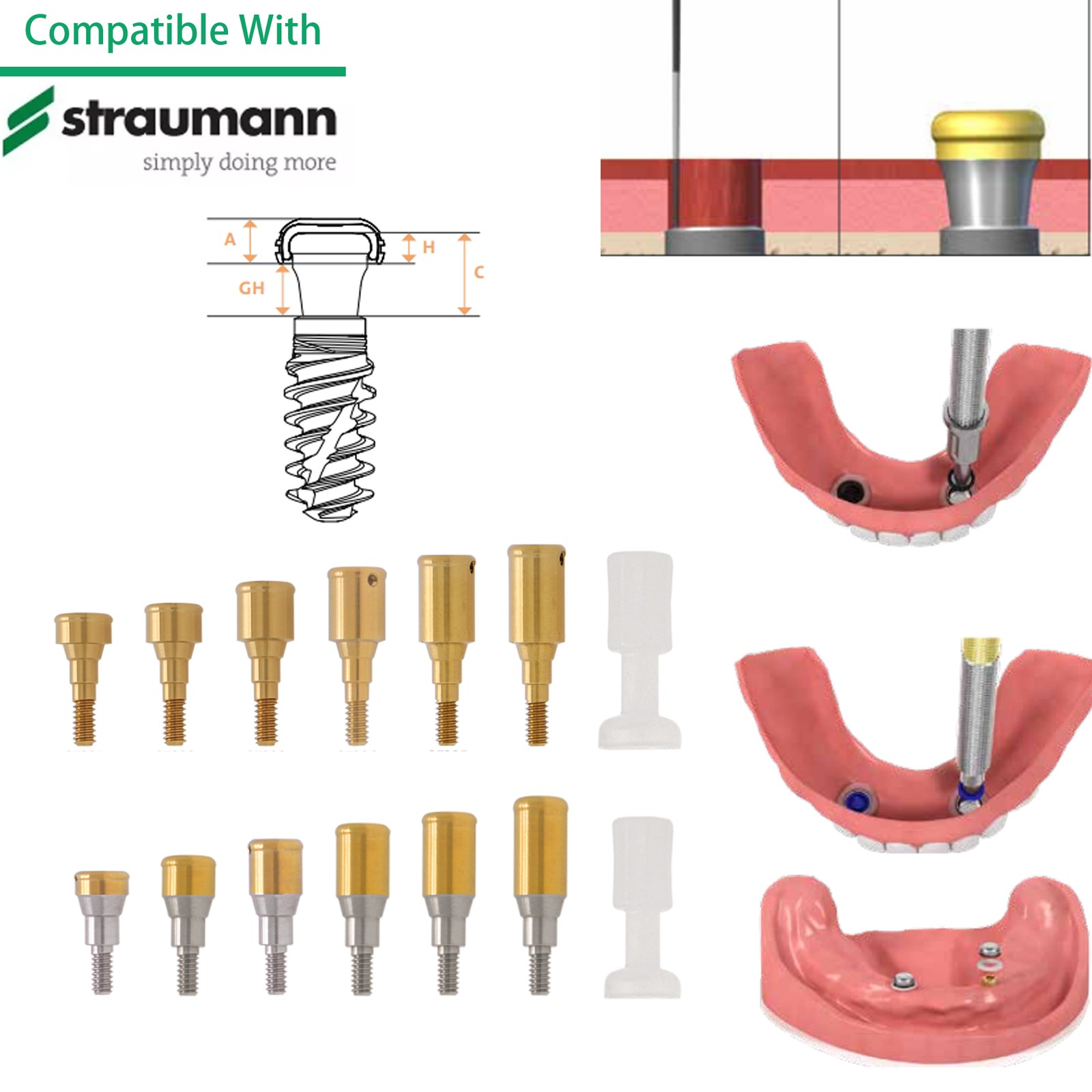 Overdenture Tapered Locator Abutment For Hiossen Nobel ITI Zimmer MIS Titanium