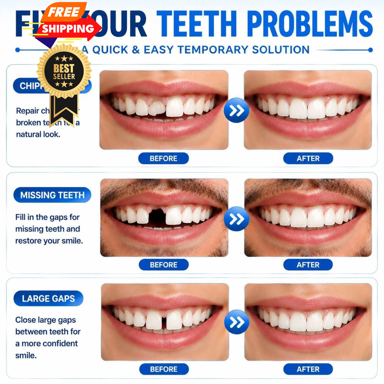 Sukh 10.9oz Moldable False Teeth Beads – Tooth Repair Kit,Repair Small, White