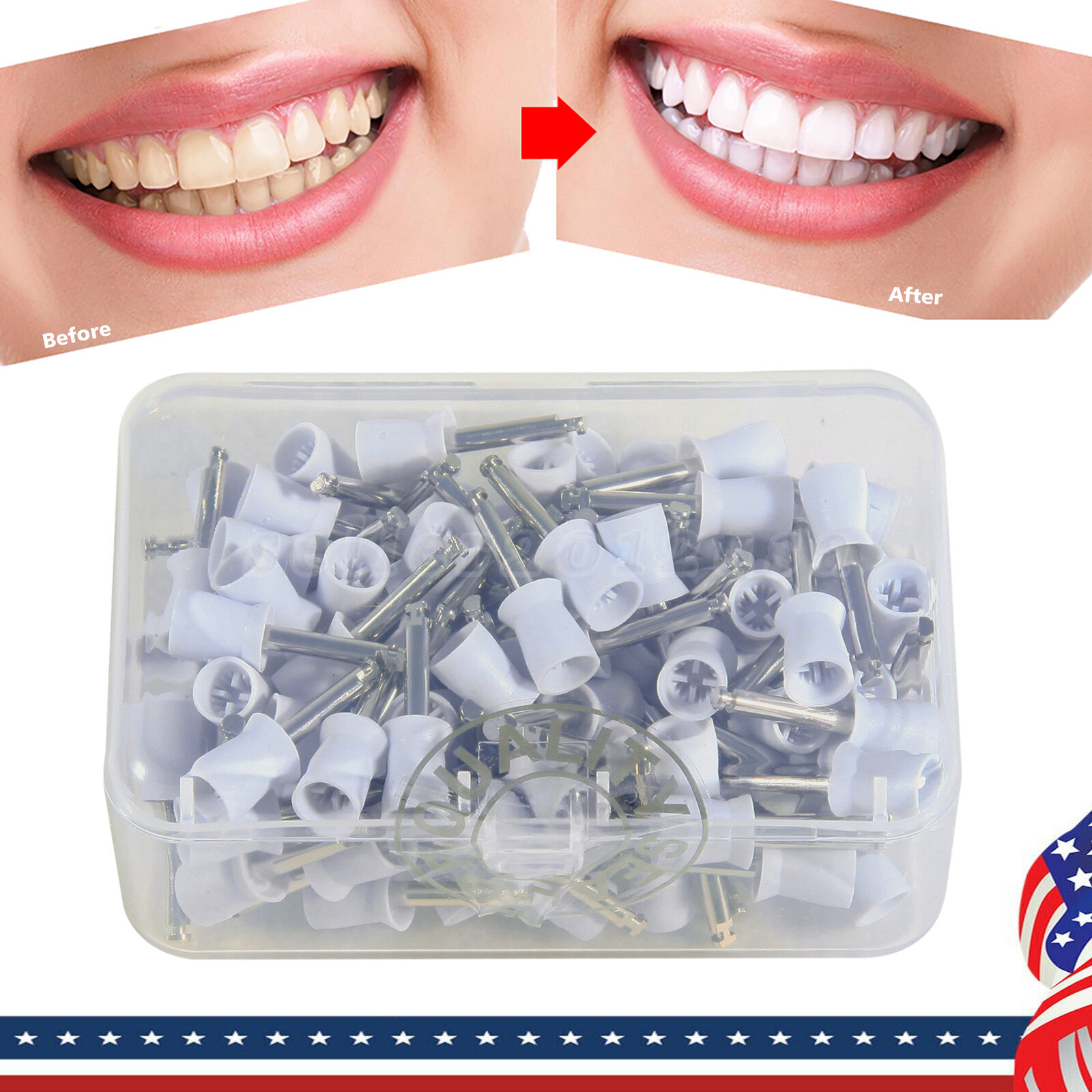 100 pieces Dental Rubber Prophy Tooth Polishing Cups brushes white polish US