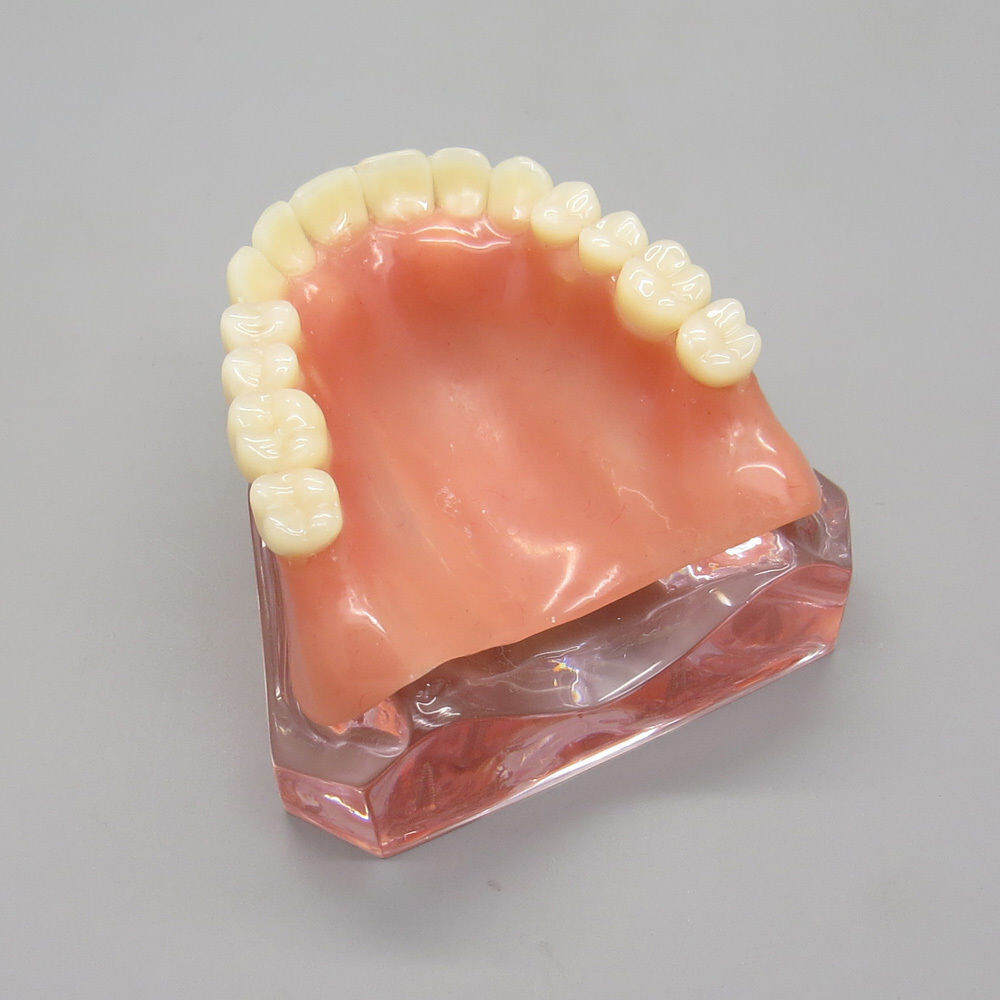 Dental High Quality Model of Upper Teeth Dentures Superior 4 Implants Maxillary