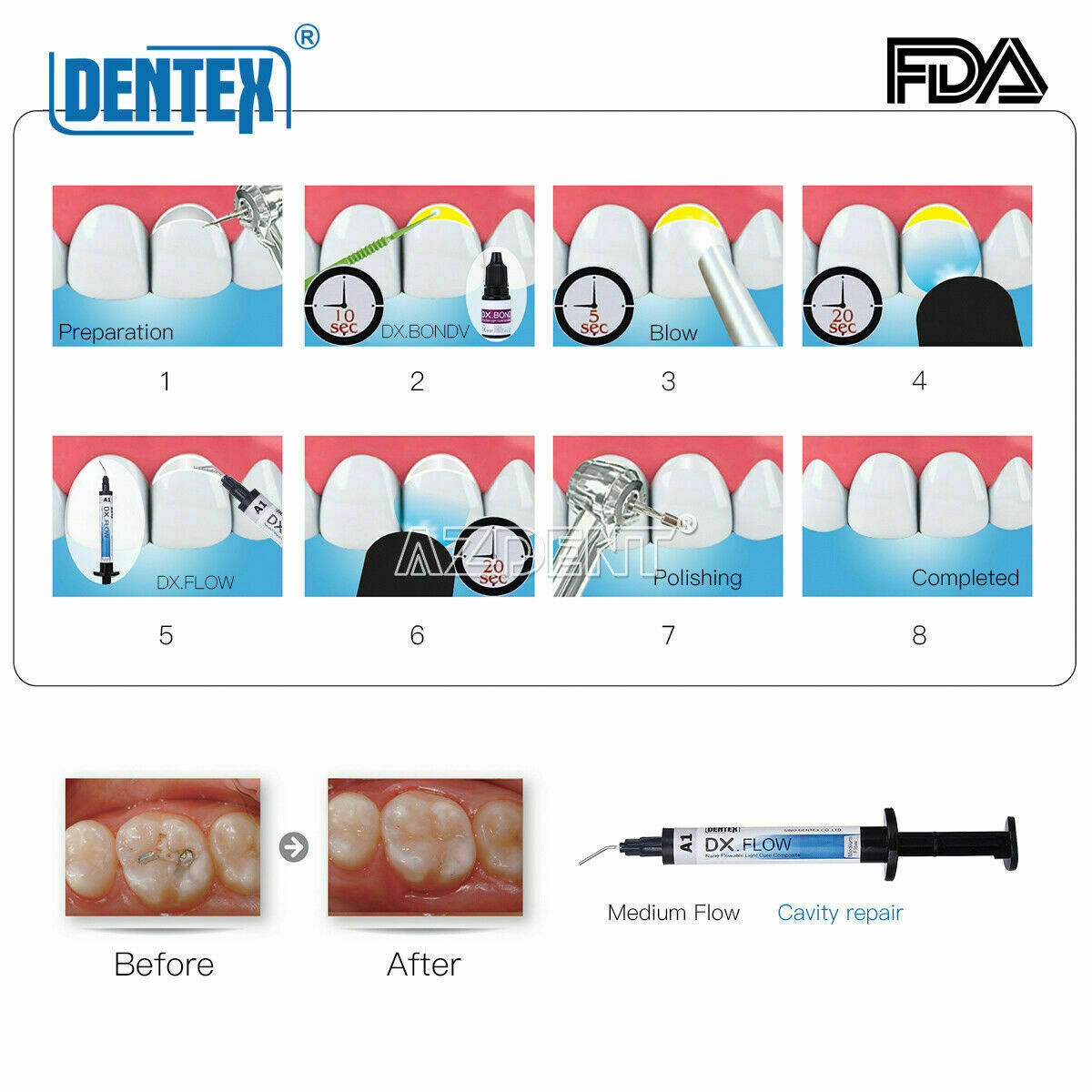 DENTEX Dental Flowable Light Cure Hybrid Composite Resin Medium Flow A1 3g/Kit