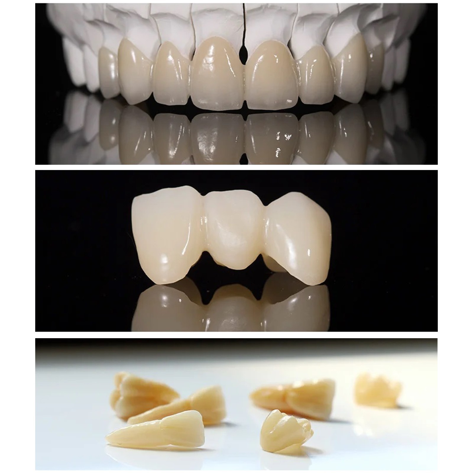 C14 Dental Emax Ceramic Blocks Lithium Disilicate CAD/CAM CEREC Block 5Pcs/box
