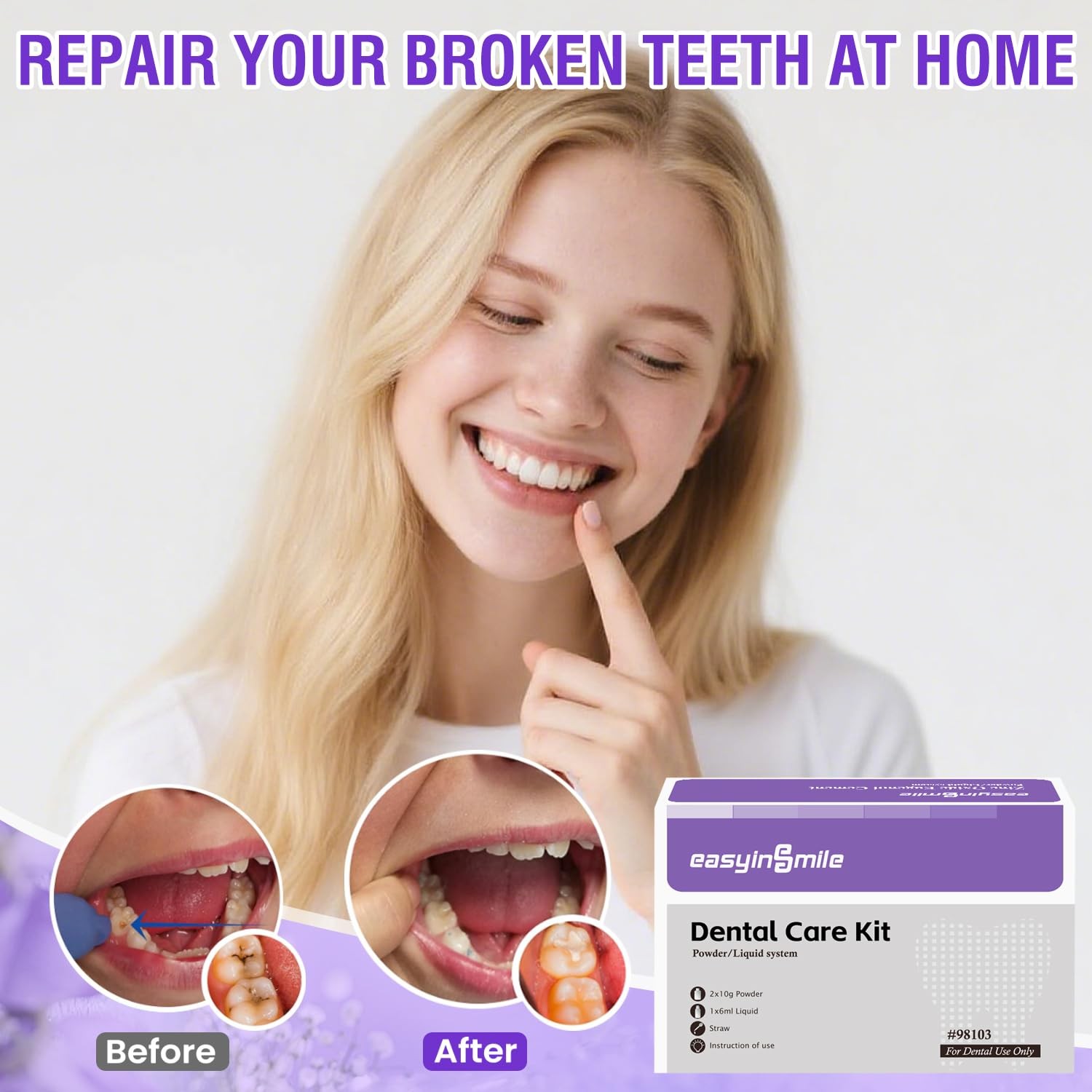 Dental Cement Temporary Tooth Repair Kit for Broken Teeth, Zinc Oxide Eugenol Gl
