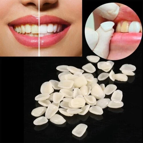50Pcs Dental Temporary Crown Veneers for Anterior Teeth Whitening/Restoring