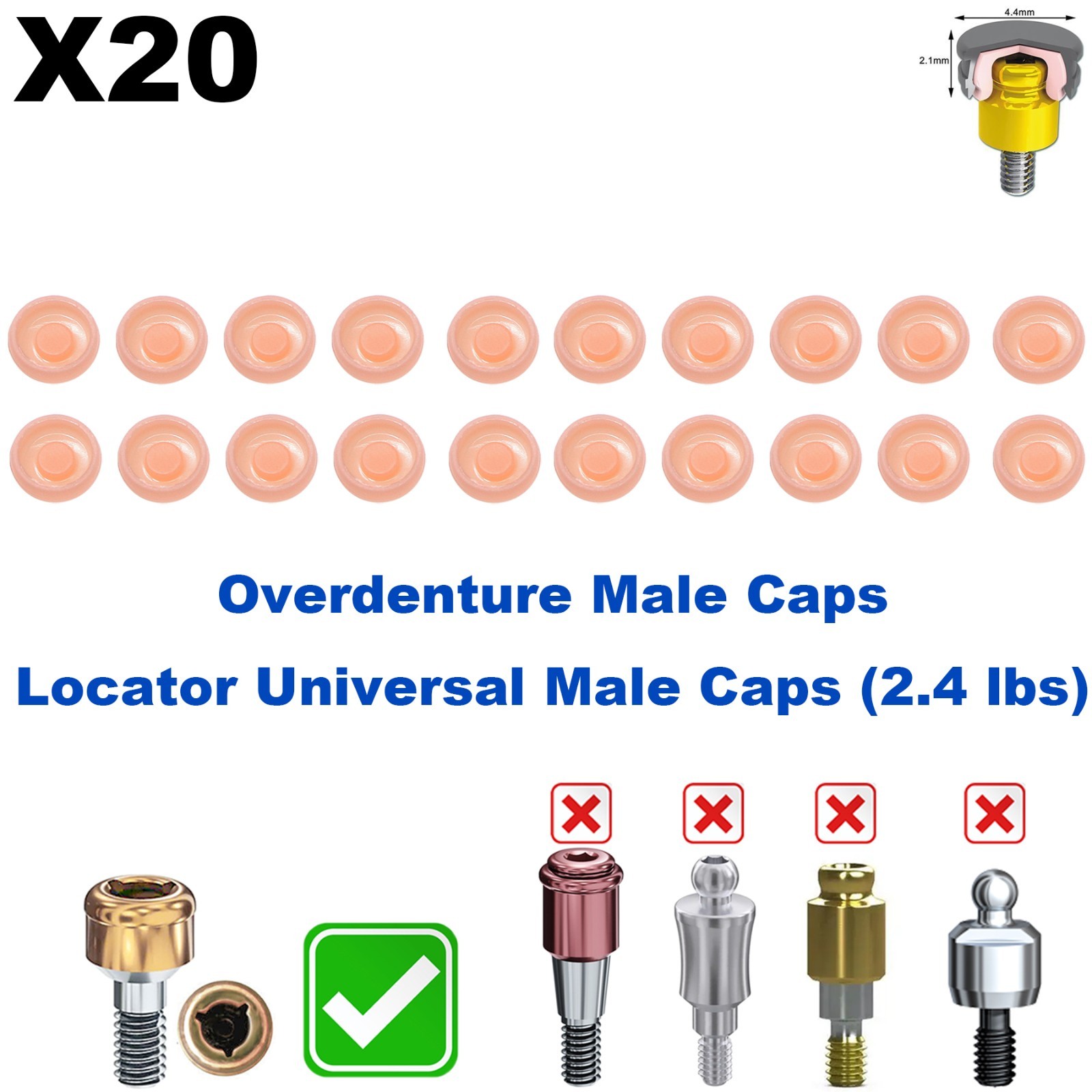 US 20Pcs Overdenture Abutment Retention Caps For Dental Locator Inserts Implant