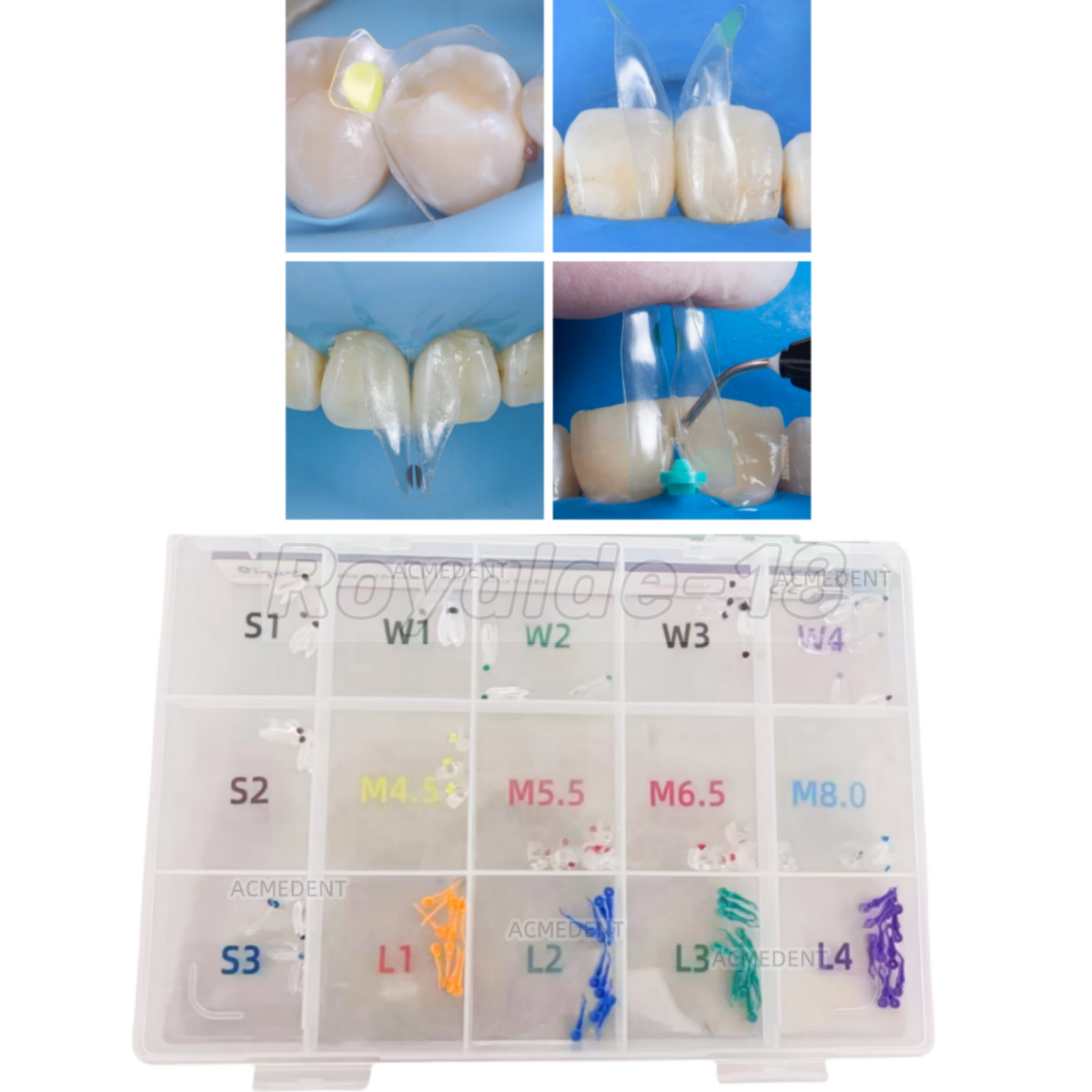1Box Dental Clear Matrix BT Matrices Black Triangle Wedge Diastema Fits BioClear