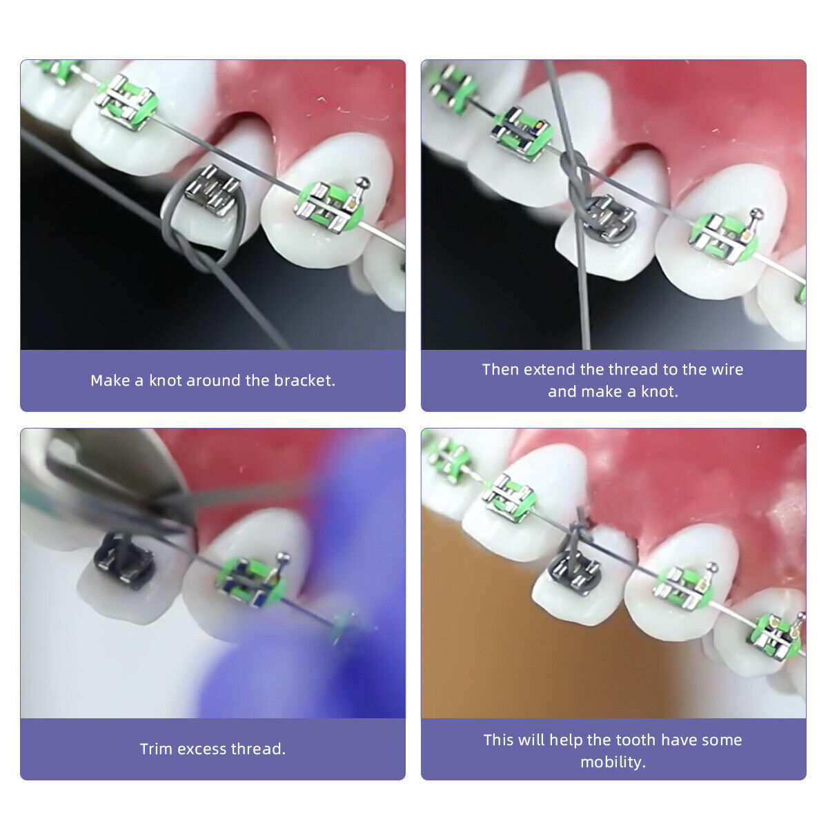 Dental Orthodontic Solid Elastic Thread Traction Pulling 020 025 030 Transparent