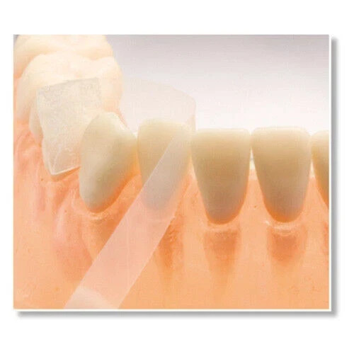 100 Pcs/Box Dental Plastic Strips Transparent For Crown Form TOP BM 1.040/1.041