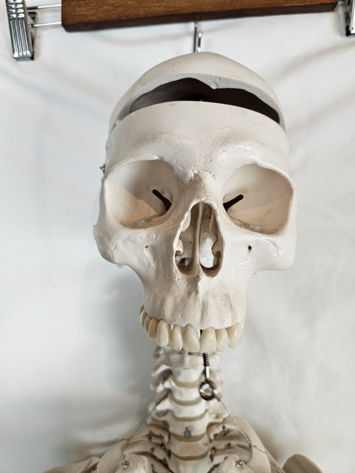 3B Scientific 5′ 6″ Human Skeleton Stan Hanging Model NO MANDIBLE