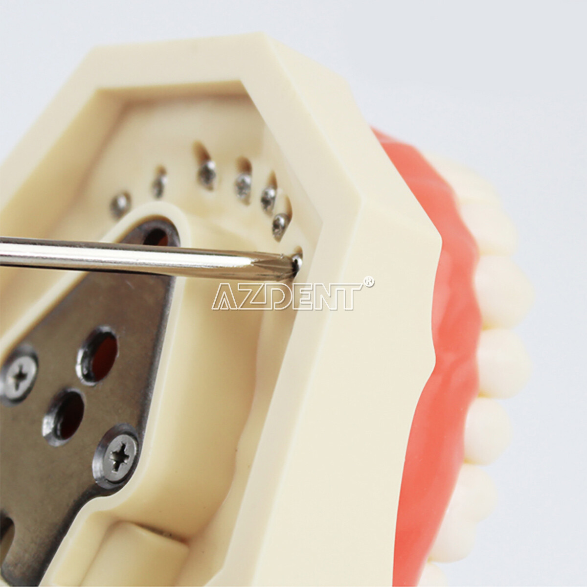 Dental Implant Teeth Model U/ L Demo Overdenture Restoration w/ 2 4 Implants