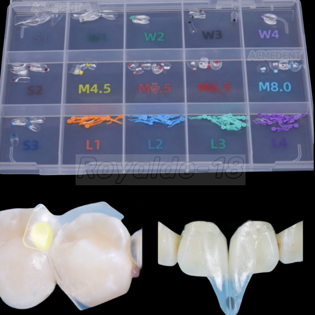 1Box Dental Clear Matrix BT Matrices Black Triangle Wedge Diastema Fits BioClear